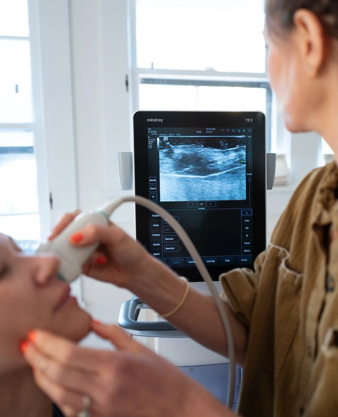 Ultrasound before injecting adds an extra layer of safety and precision. High-frequency imaging lets me see vessels, tissue planes, and any prior filler in real time so we can plan smarter.

Why it helps:
 🖤 Confirm needle depth and product placemen