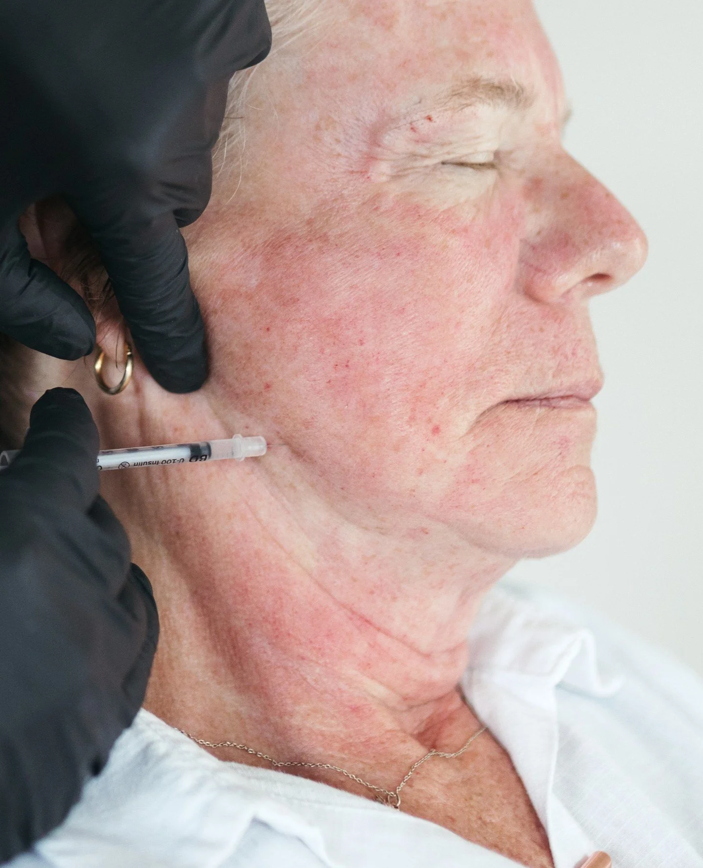 Welcome to thoughtful, regenerative aesthetic care in Northeast Portland.

Every treatment is designed to support your skin&rsquo;s natural function. Whether we&rsquo;re working with Botox/Dysport/Daxxify, microneedling, or bio-regenerative options l
