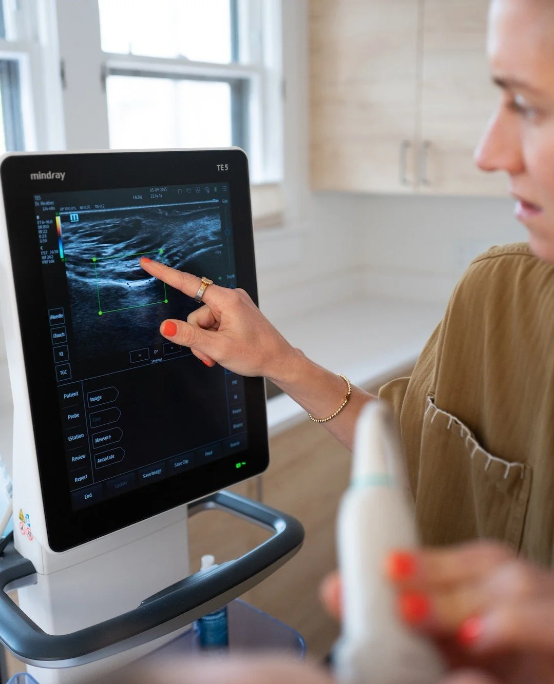 Wondering about your filler? Ultrasound evaluation for dermal filler assessment uses imaging to visualize where filler has been placed, assess its condition, and determine if any adjustments are needed. This appointment is ideal for those who:

🖤 Ha