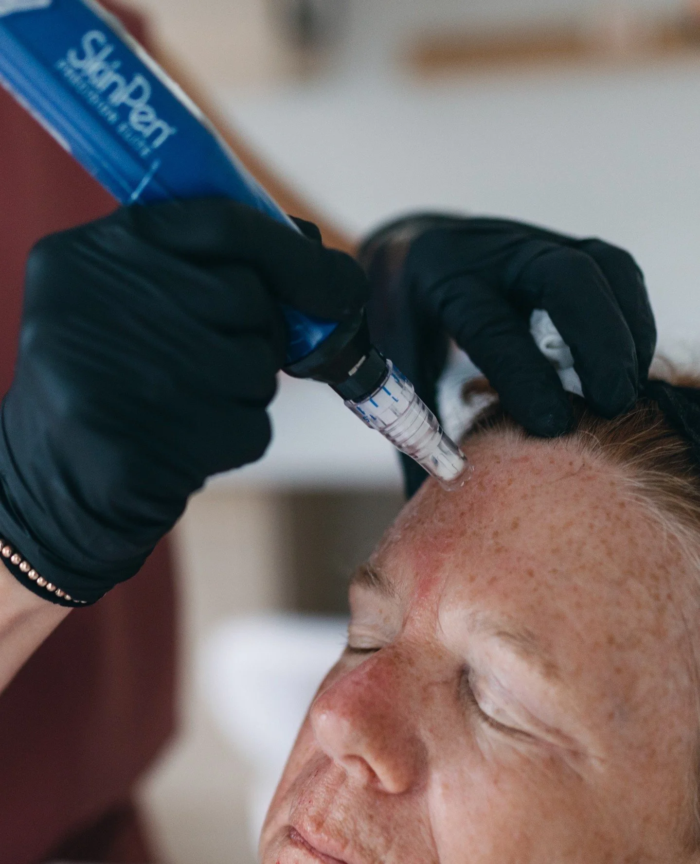 Microneedling appointments open in January and February. If you can't find your preferred time, add yourself to my waitlist. 

This is one of the most effective ways to stimulate collagen, improve skin texture, and support long-term skin health.

Lin