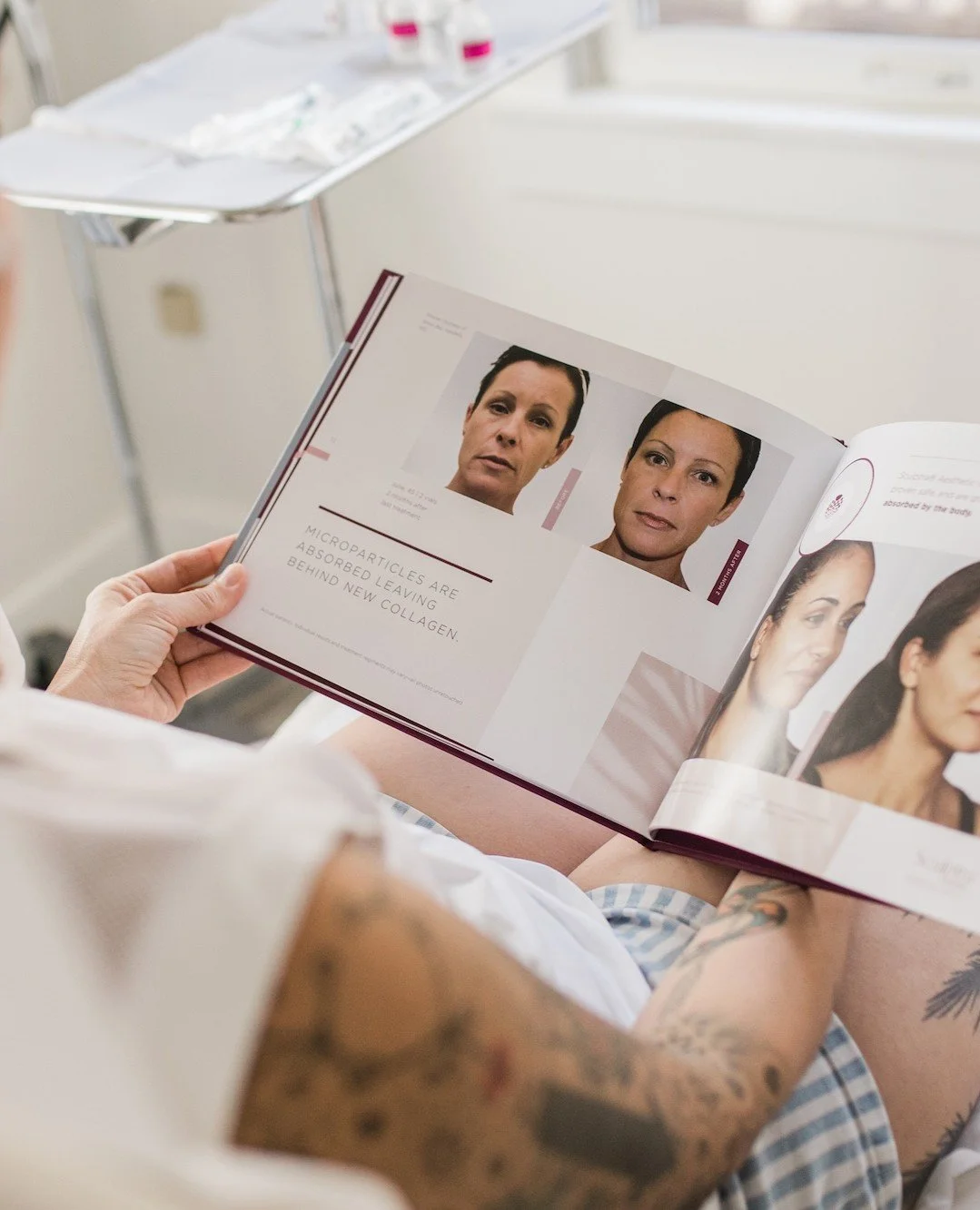 I&rsquo;ve always believed that Botox isn&rsquo;t about freezing your face; it&rsquo;s about freeing your face from looking unintentionally angry, stressed, or exhausted. If you&rsquo;ve been curious about trying Botox, I am accepting new patients th