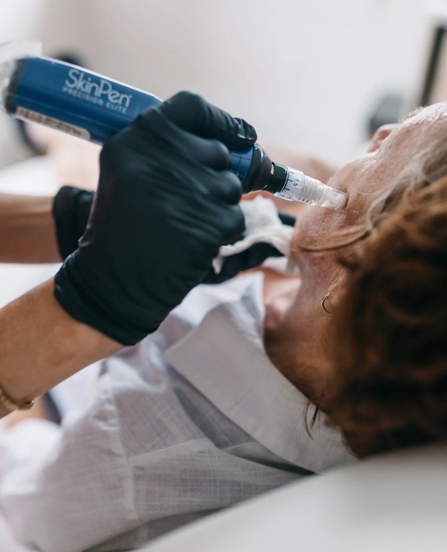 Lower sun exposure makes now an ideal time to begin or continue a microneedling series. Starting in February allows collagen to build gradually before spring and summer.
#FebruarySkinCare #Portland #Microneedling