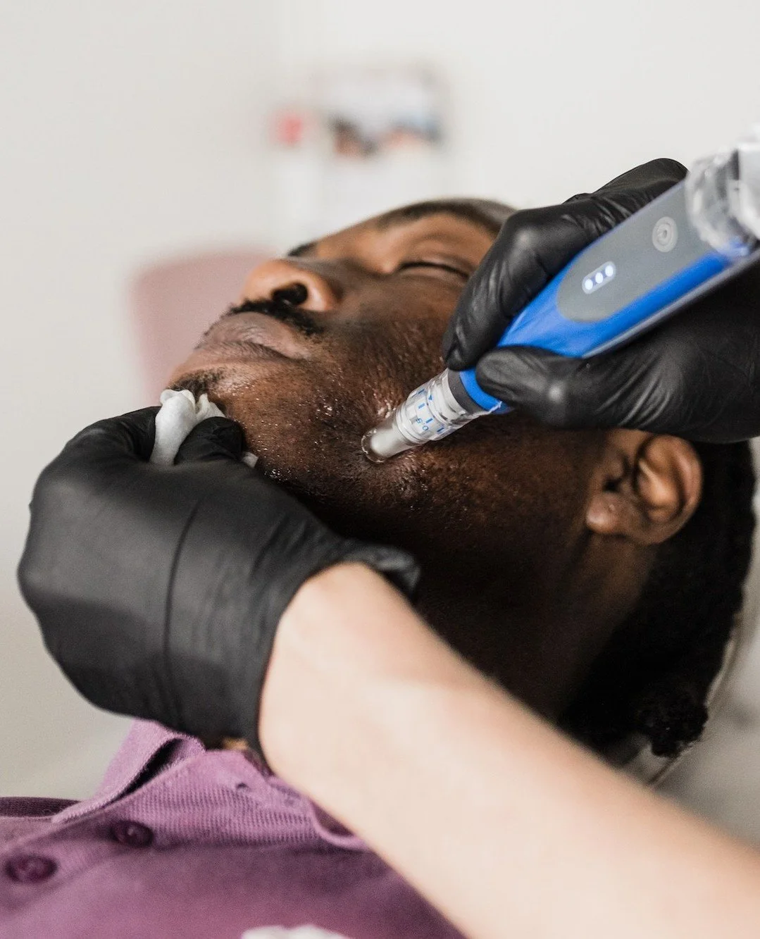 The goal is natural change. By activating your body&rsquo;s natural repair process, microneedling supports collagen, strengthens skin structure, and improves texture over time.
#Microneedling #Oregon #PDX