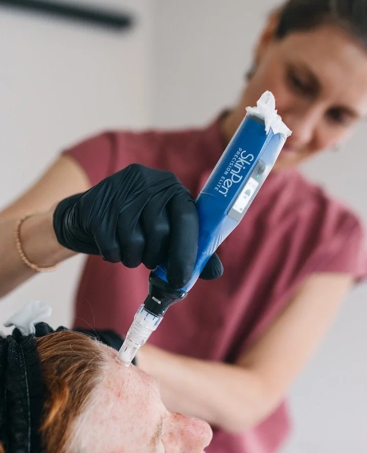 Microneedling w/ PRF
🖤 Stimulates collagen and elastin production
🖤 Improves texture and tone
🖤 Softens scarring and hyperpigmentation
🖤 Enhances product absorption
🖤 Supports deeper, longer-lasting healing
🖤 Promotes a healthy, natural glow
#P