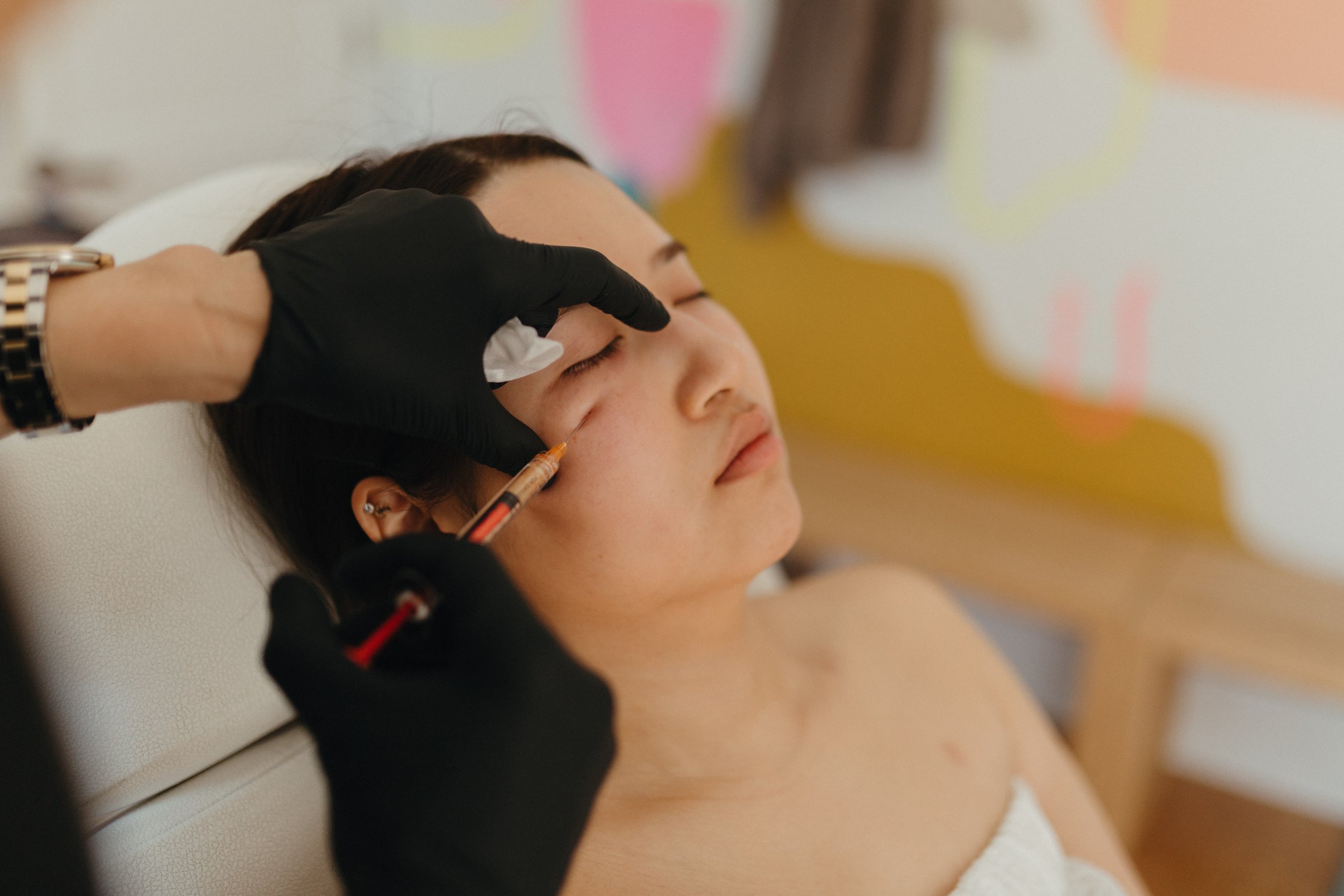 Under-Eye Rejuvenation with PRF EZ Gel