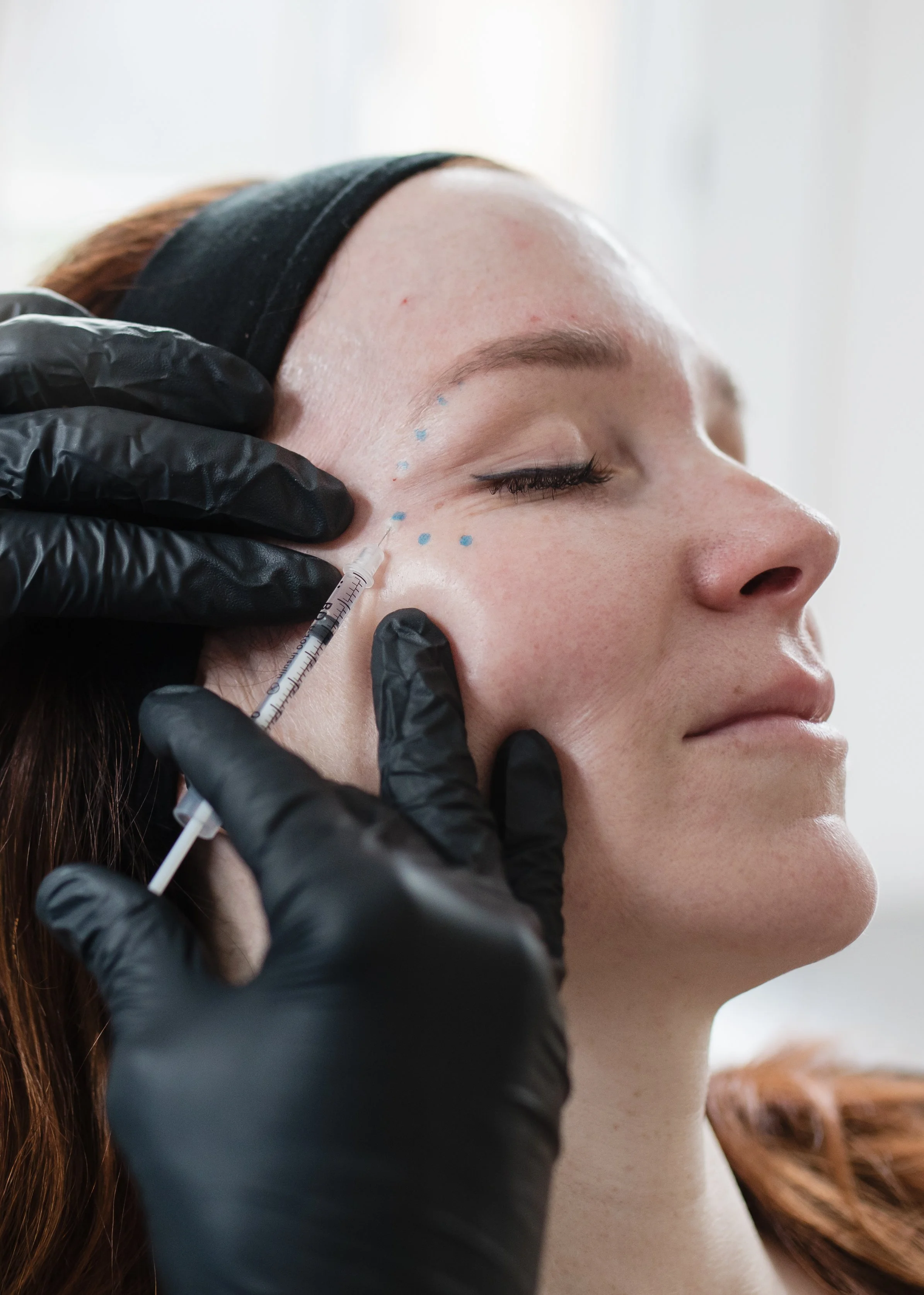A close-up of a person receiving a cosmetic injection to the face, with gloved hands holding a syringe near the eye area.
