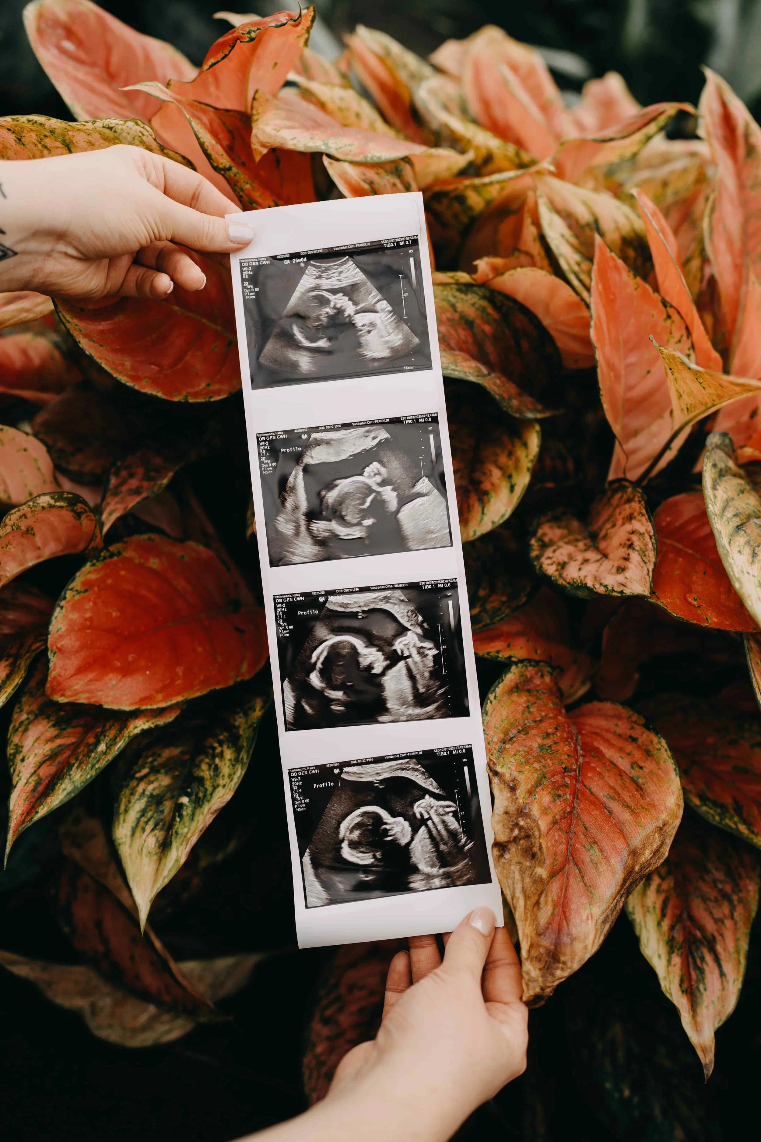 Ultrasound pictures Nashville.jpg