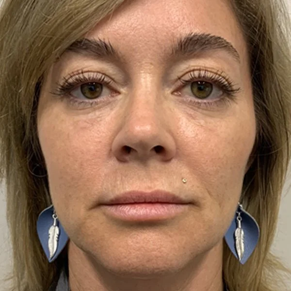 after anti-aging regimen