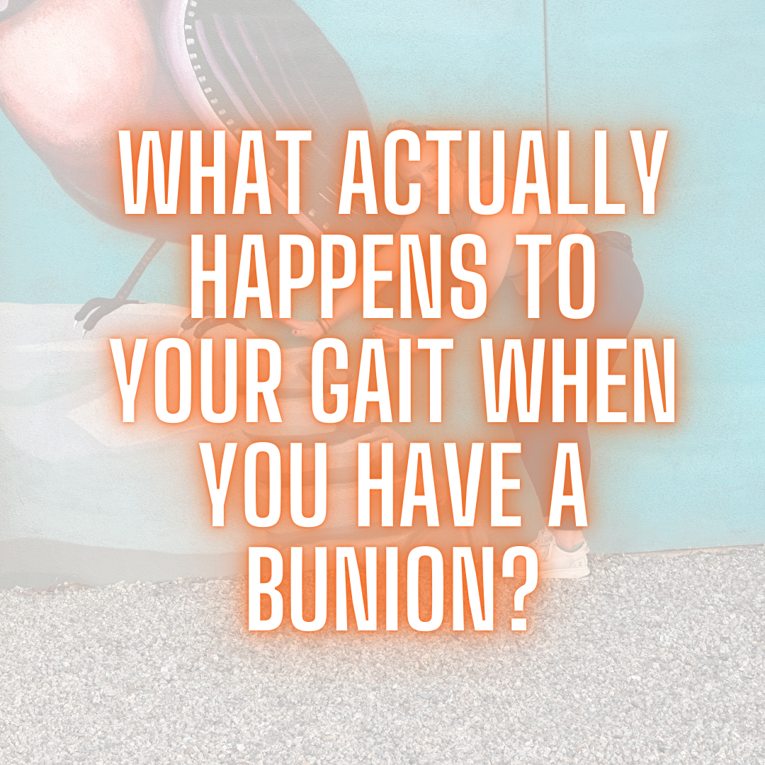 What Actually Happens to Your Gait When You Have a Bunion? A New Study Breaks It Down