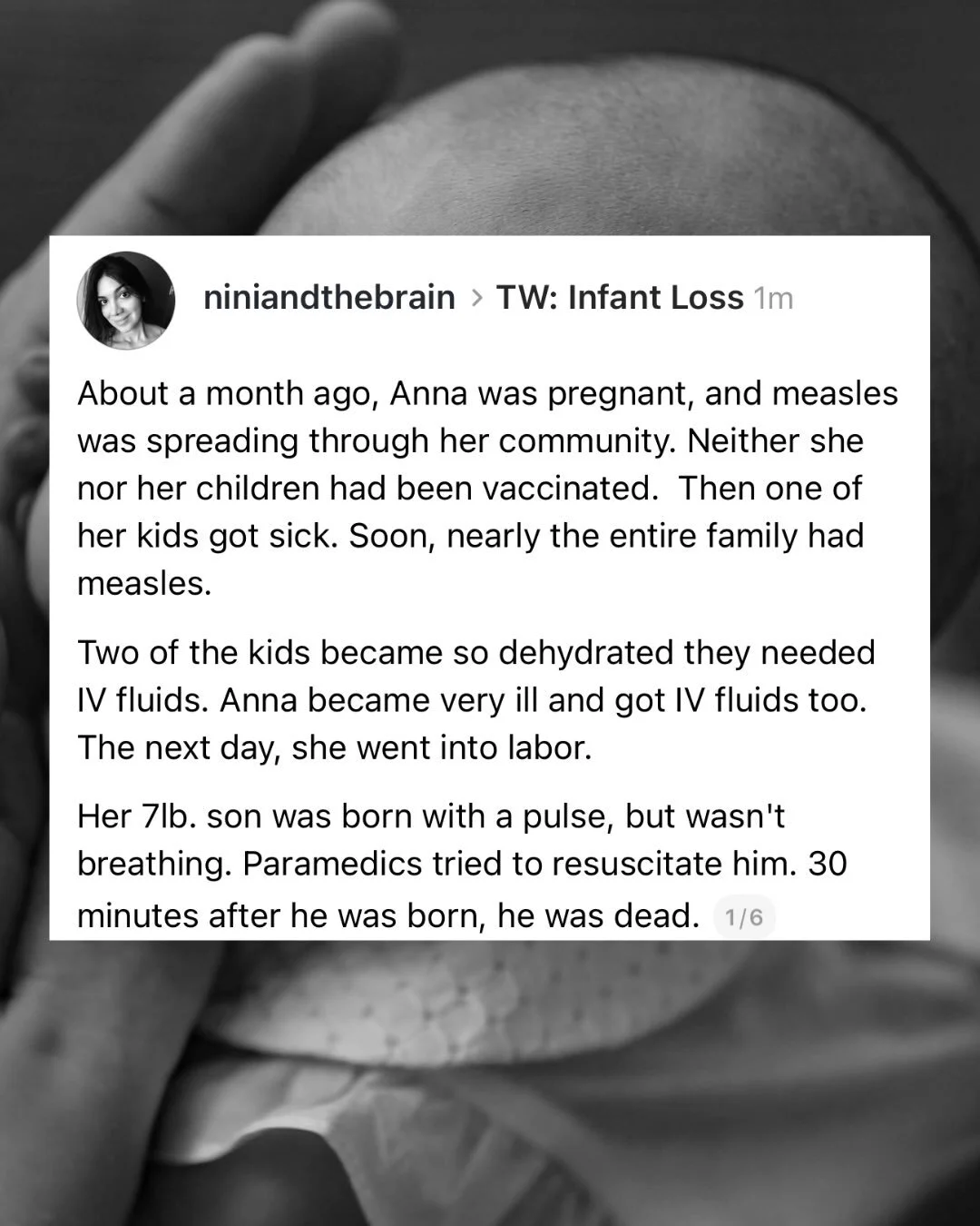 Gift article: https://www.theatlantic.com/health/2026/08/pennsylvania-measles-infant-death-family/688469/?gift=WXb-V9VUAk2DwabiCbrFEwSgYHx0gFRnmOojb9xbFbg