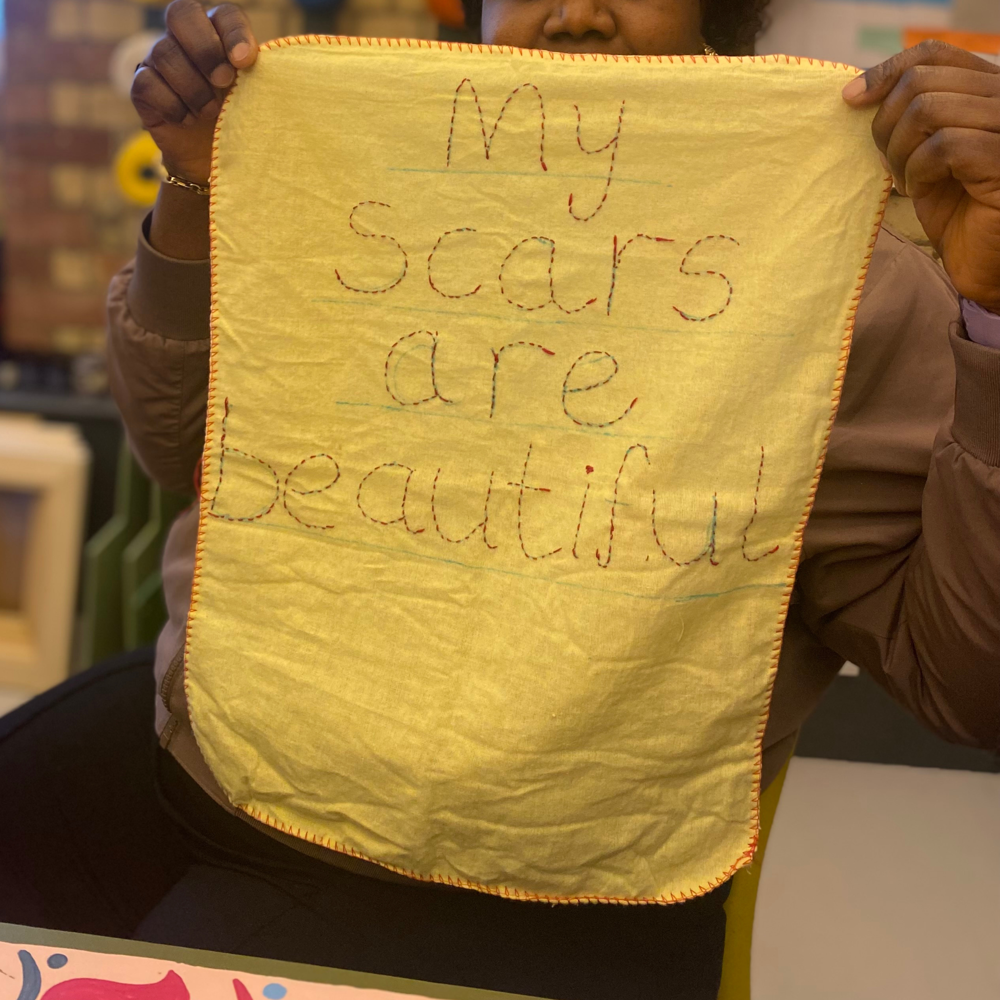 'My scars are beautiful' (Nigeria)