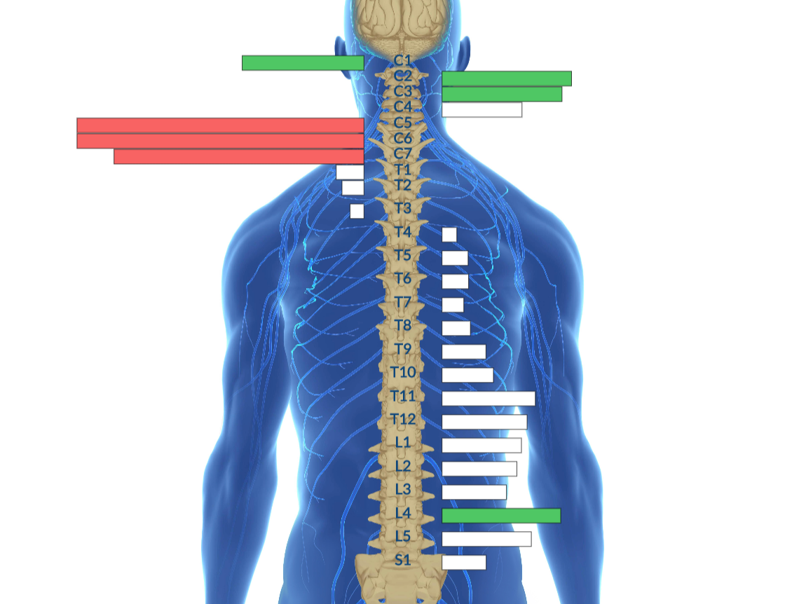 Insight Thermal Spinal Scan 