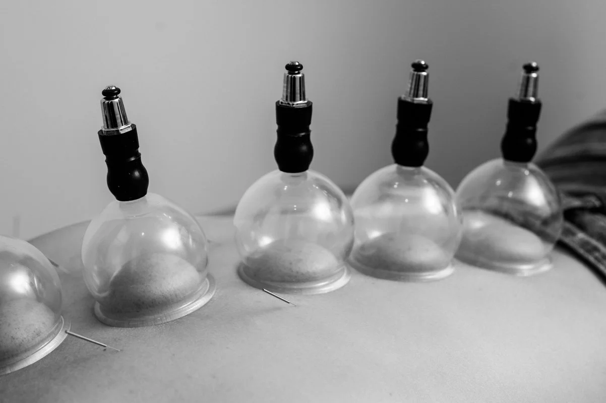 Cupping