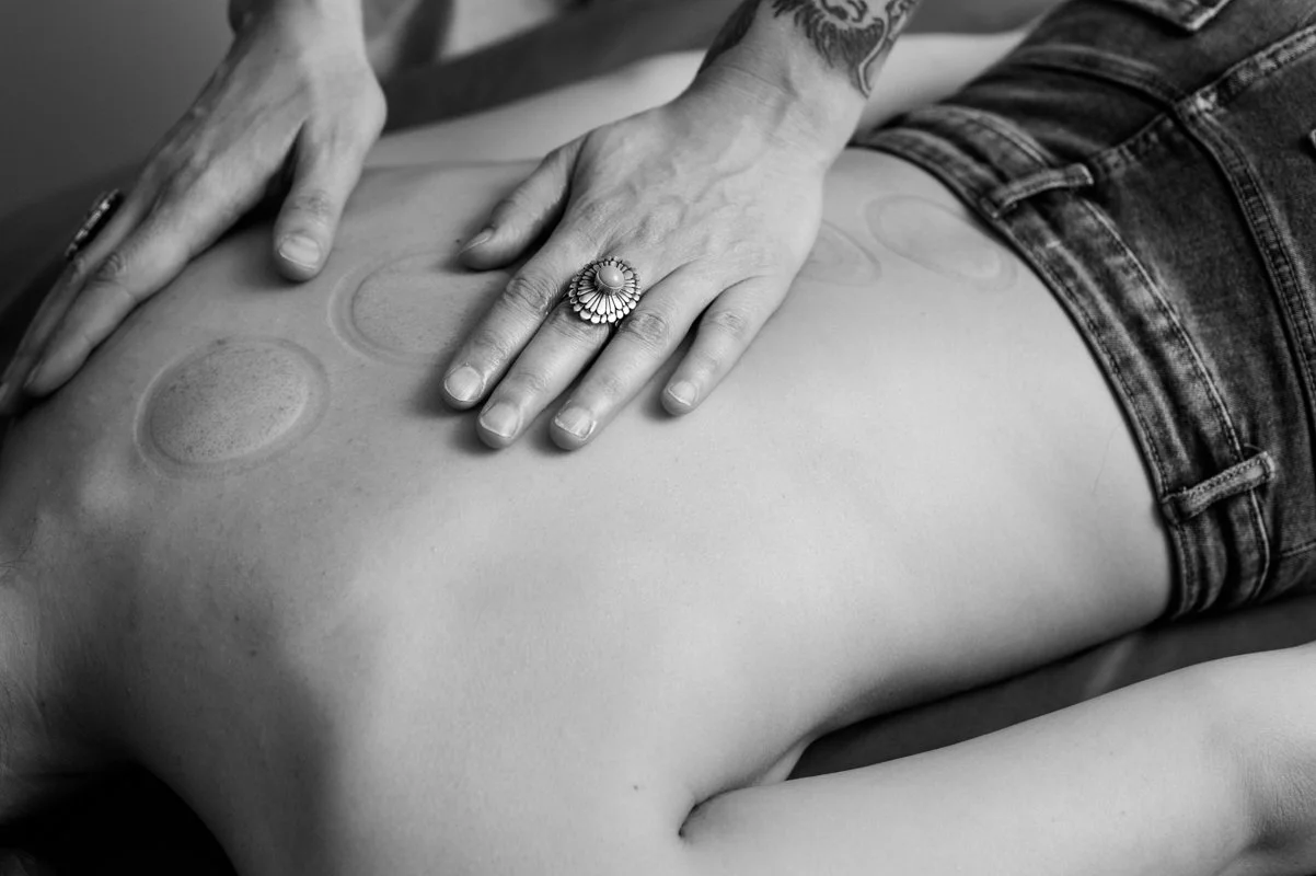 Cupping