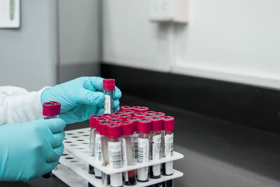 Food sensitivity tests… Are they worth it?