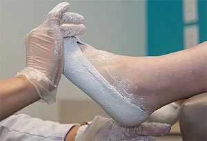 Orthotics or Arch Supports?