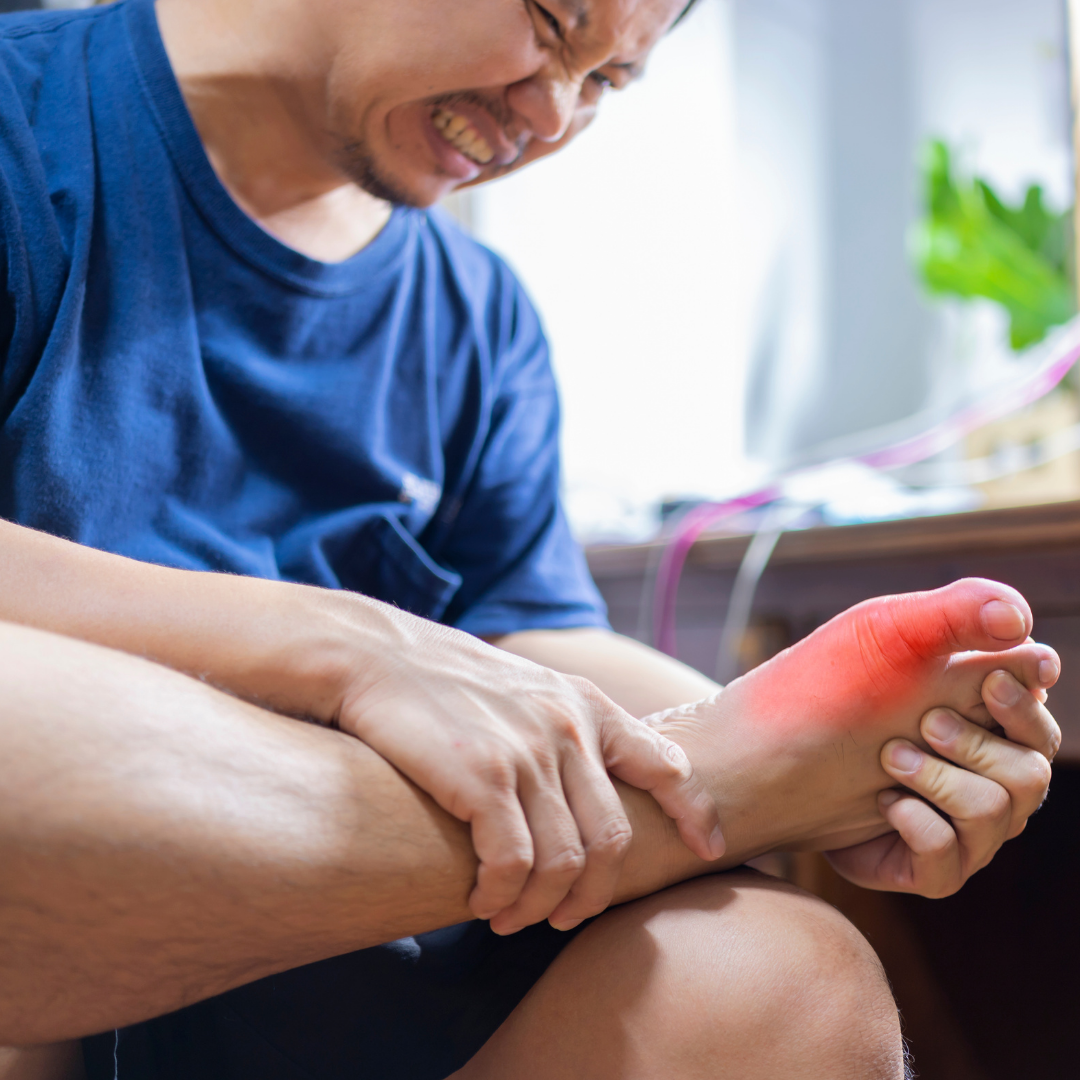 Gout or Oh My Aching Toe!