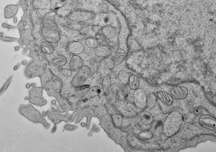 Electron microscopy image of a human hematopoietic stem cell showing hallmarks of ferroptosis, including shrunken mitochondria with fewer inner membrane folds.