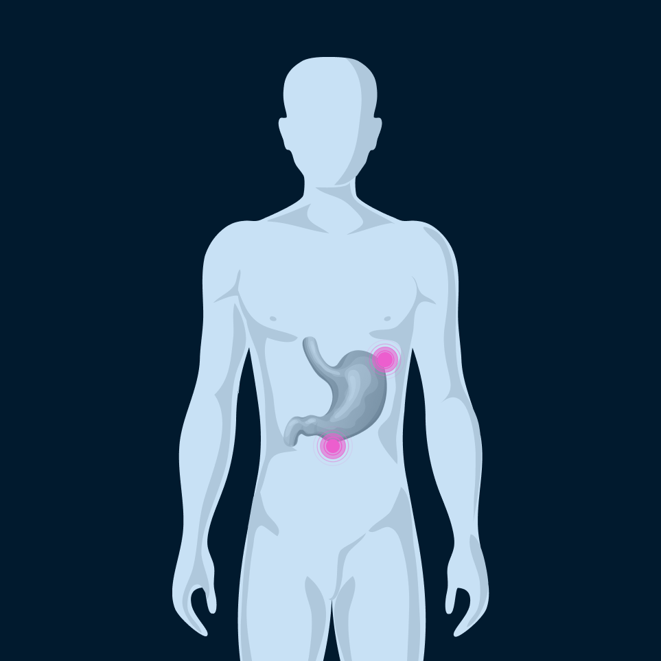 Язвенная болезнь