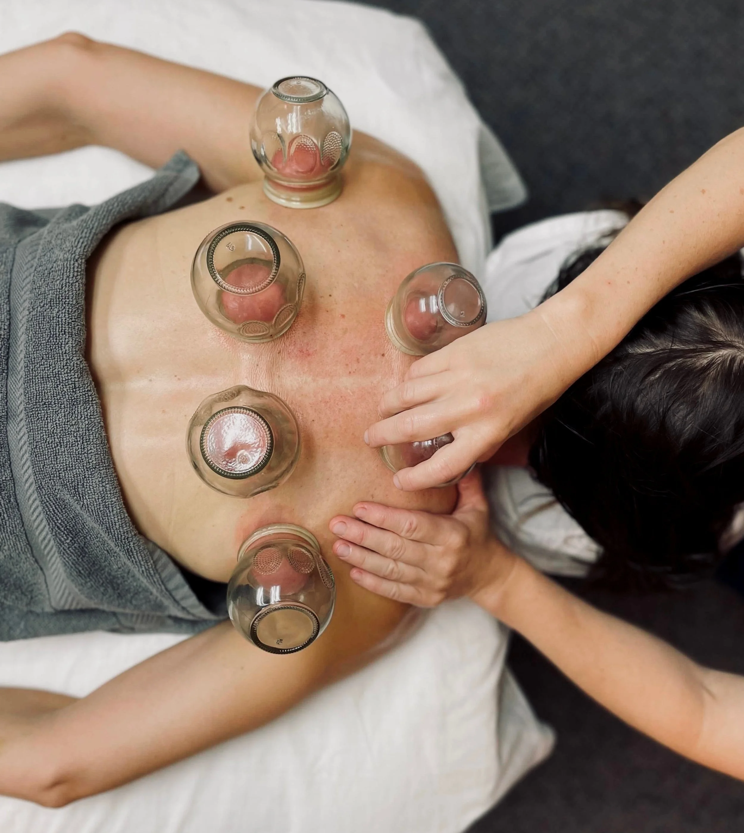 Massage, Cupping, Body work, Tui Na, Pain management, injuries