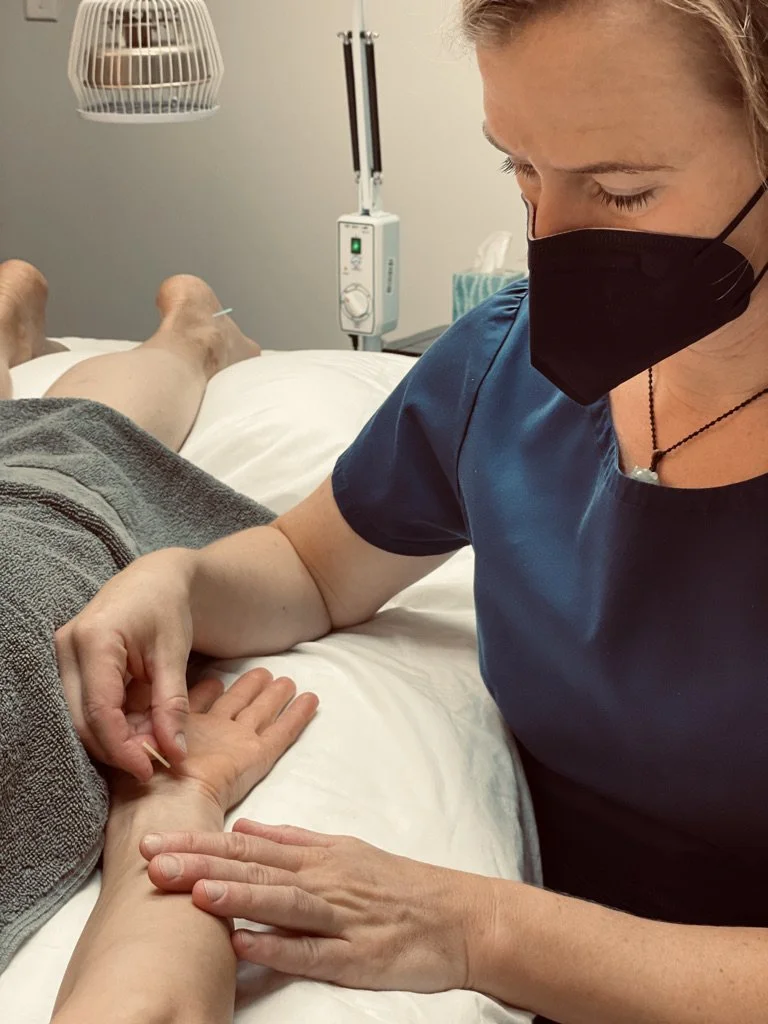 Acupuncture, Natural therapies, Healing