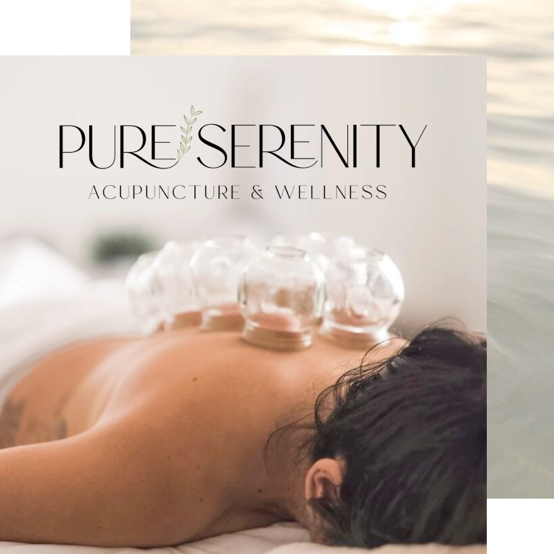 A person receiving cupping therapy with glass cups on their back, under a logo that says 'Pure Serenity Acupuncture & Wellness.'