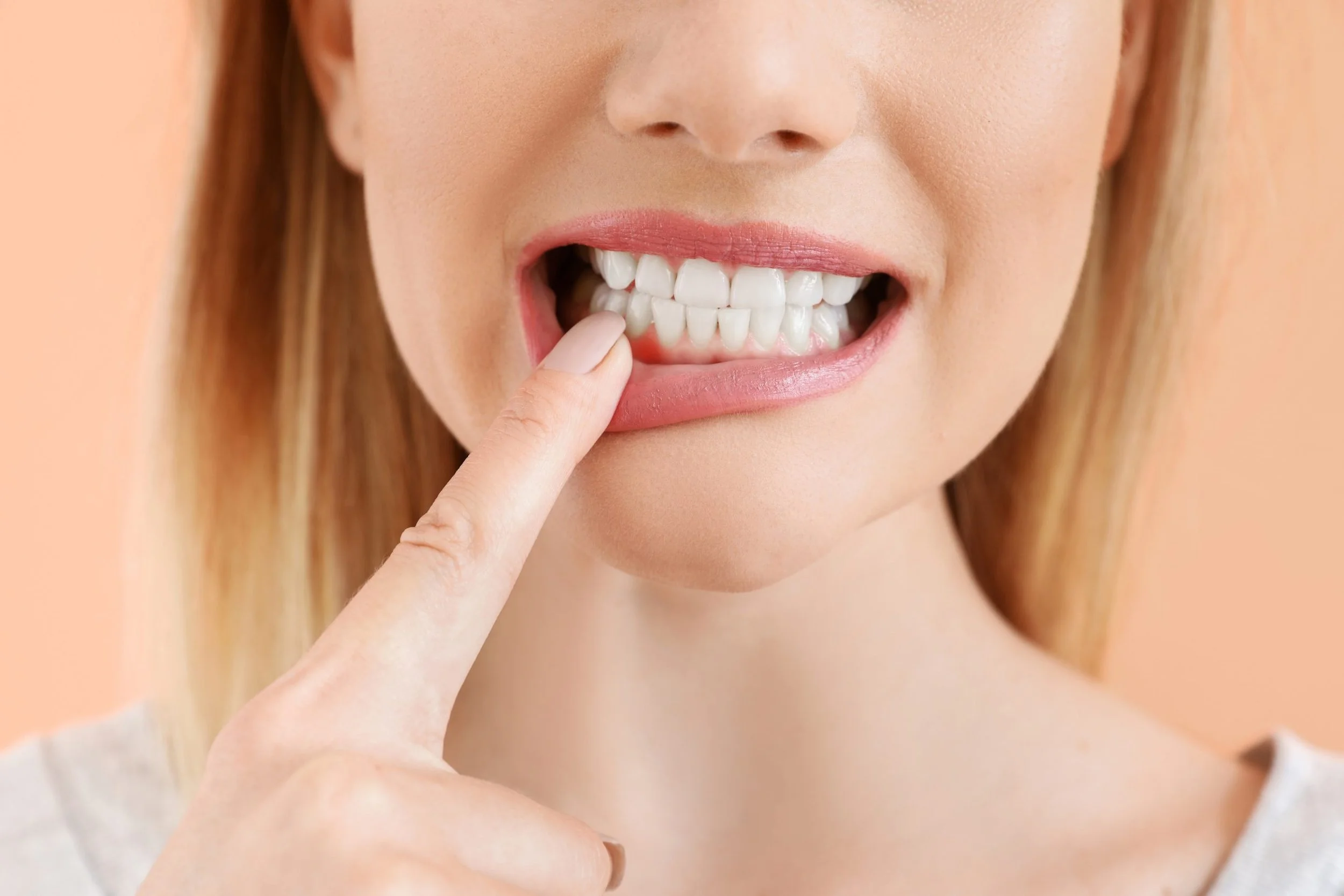 What Is Periodontal Disease?