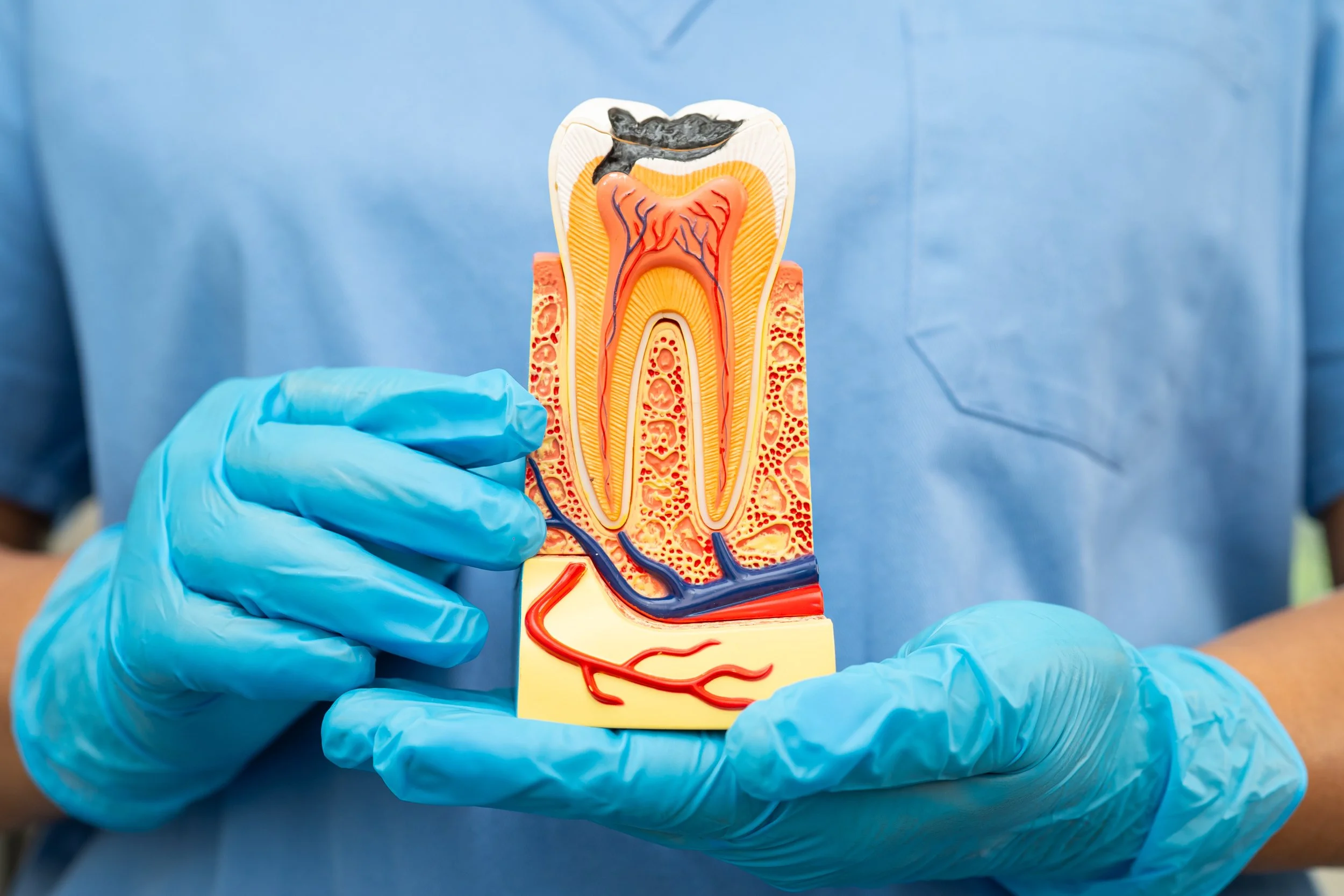 How Do I Know If I Need a Root Canal?