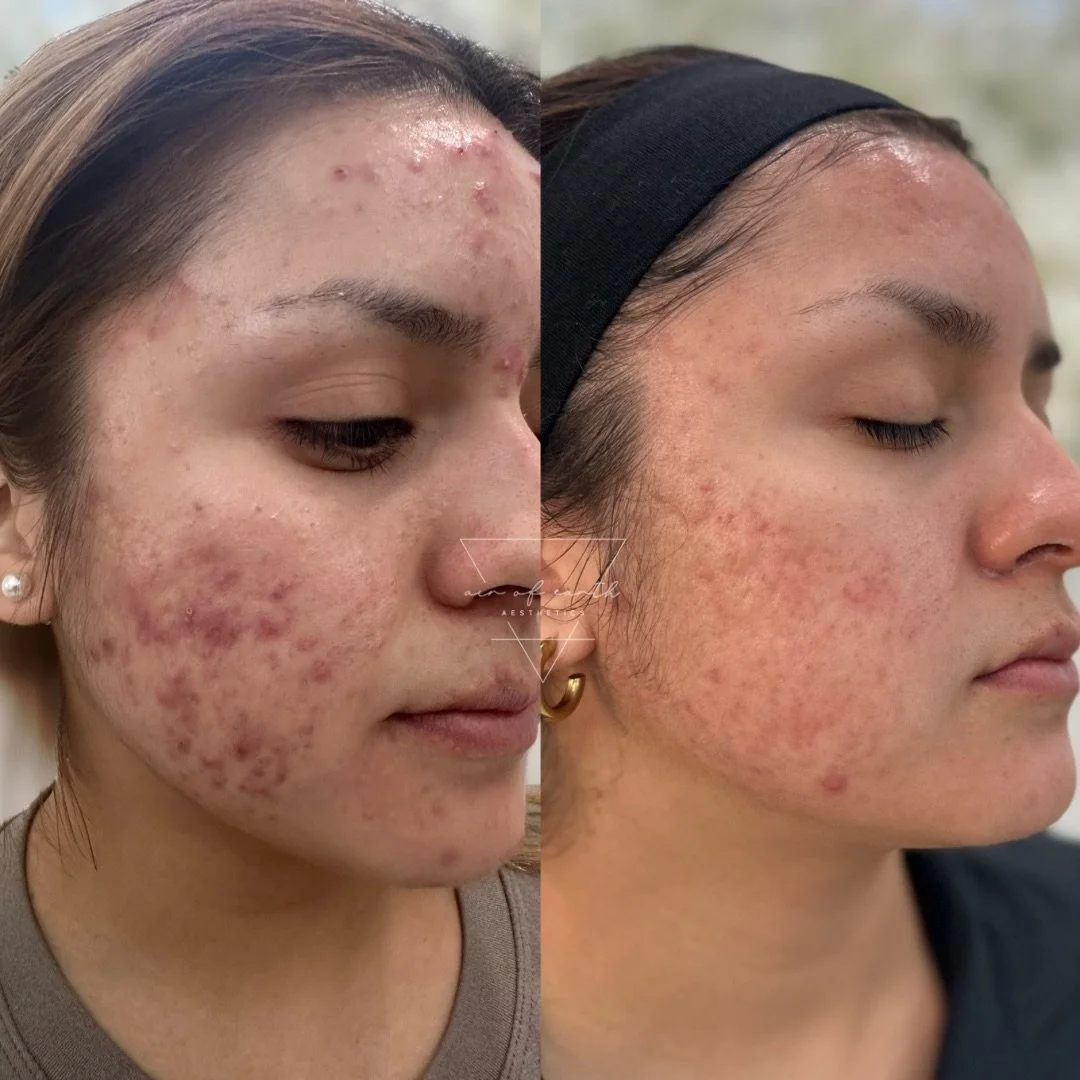 Untitled design - 2.JPG