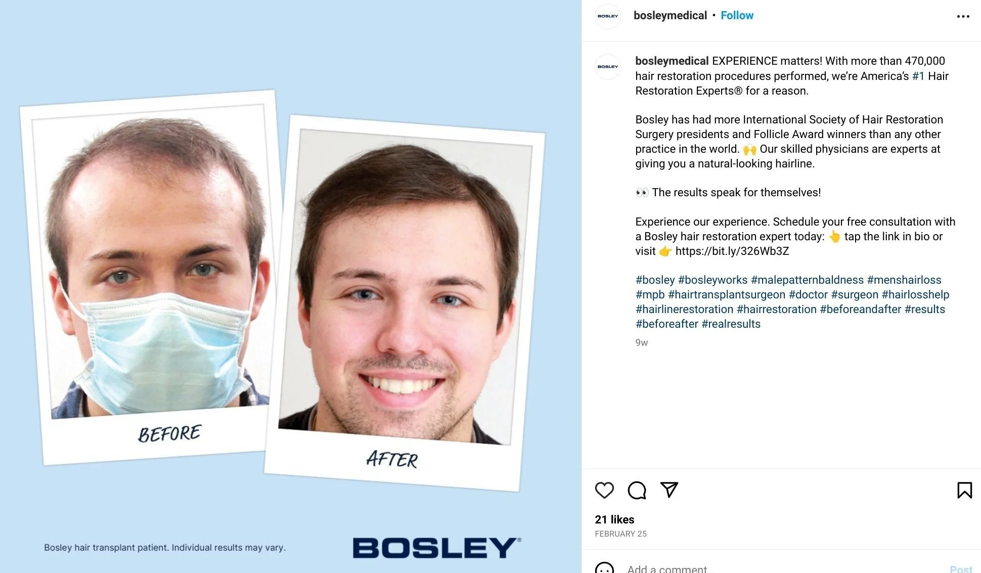 Before + After for Bosley Hair Restoration
