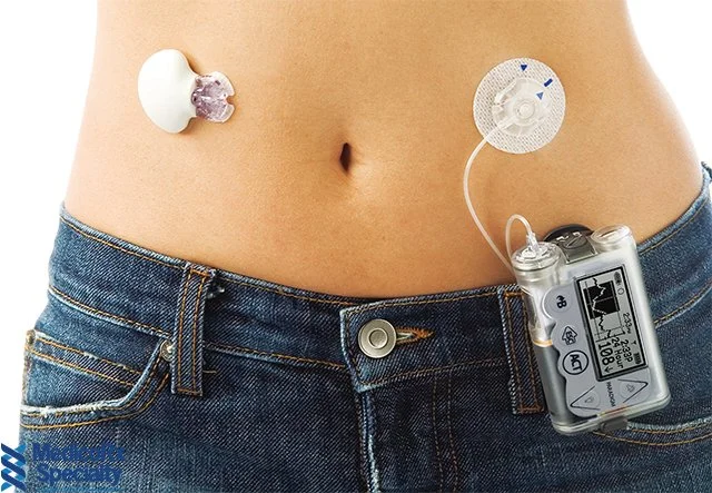 article-insulin-pump-therapy.jpg