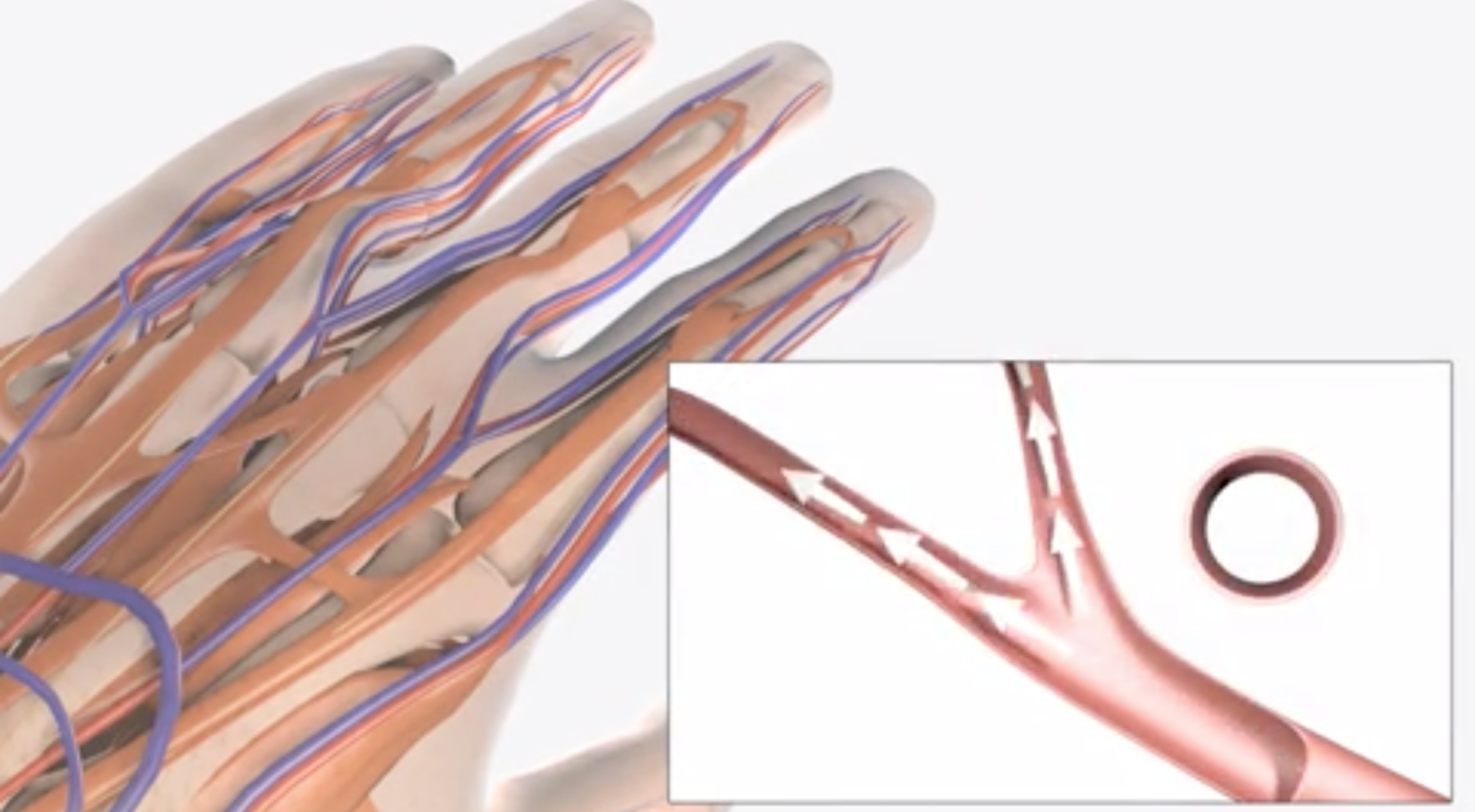 Hand_Arm_Vibration_image_iHASCO.png