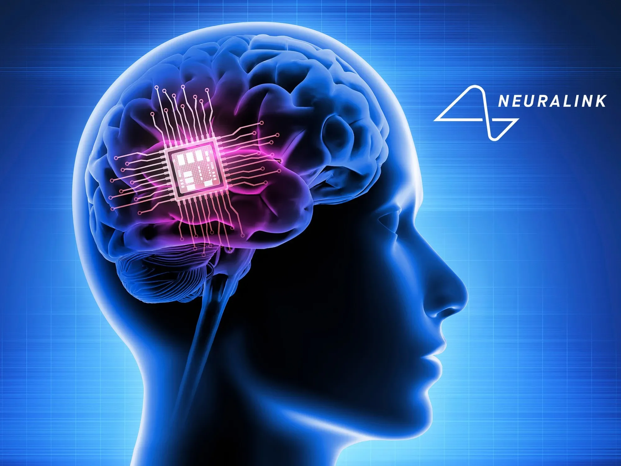 Neuralink's Leap: From Sci-Fi to Everyday Reality