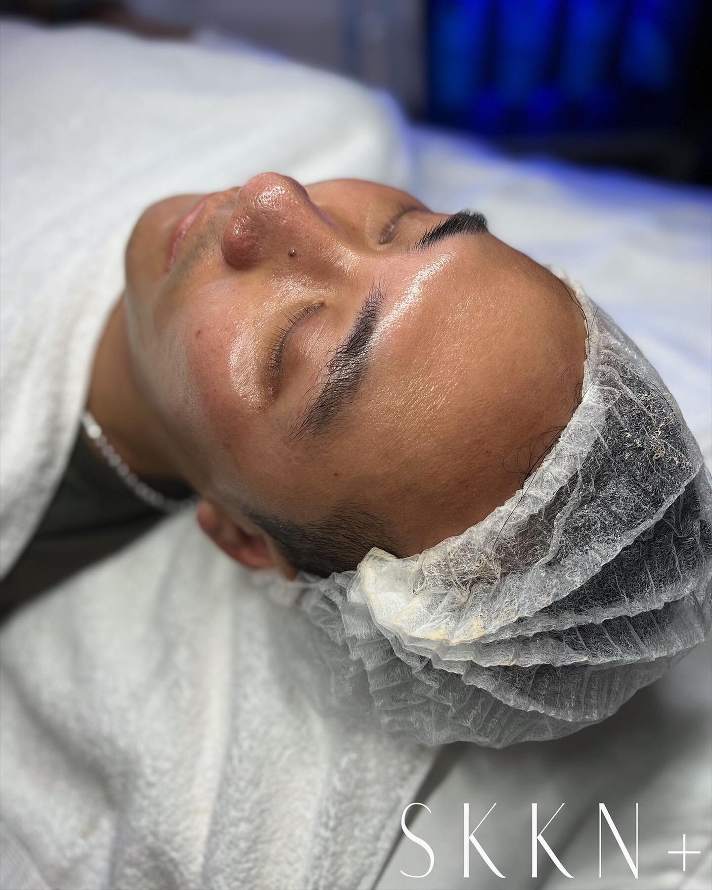 + | The focus for this facial was blackhead removal and hydration! We highly recommend @skinbetter &lsquo;s Solo Hydrating Defense for Men. This is an all-in-one treatment serum that absorbs quickly into the skin without clinging to facial hair ✨
+
+