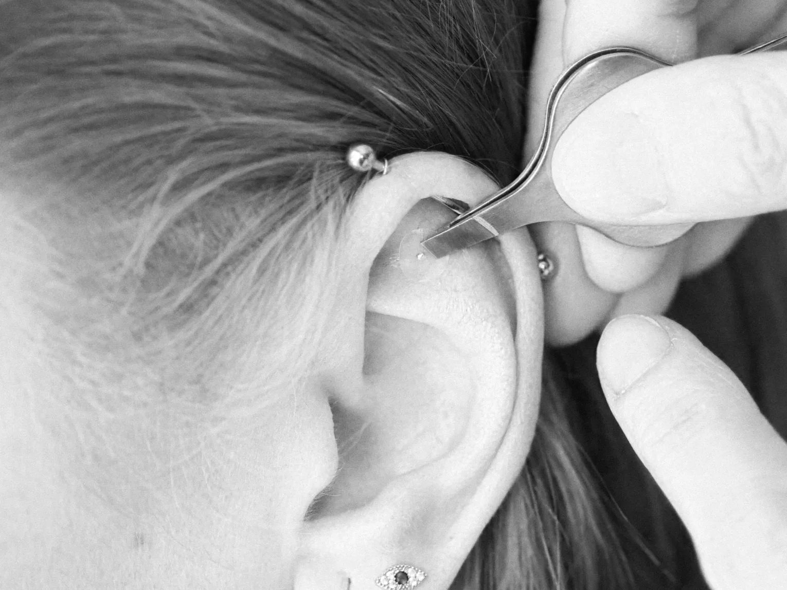 How to Use the point Ear Shen Men to Relax