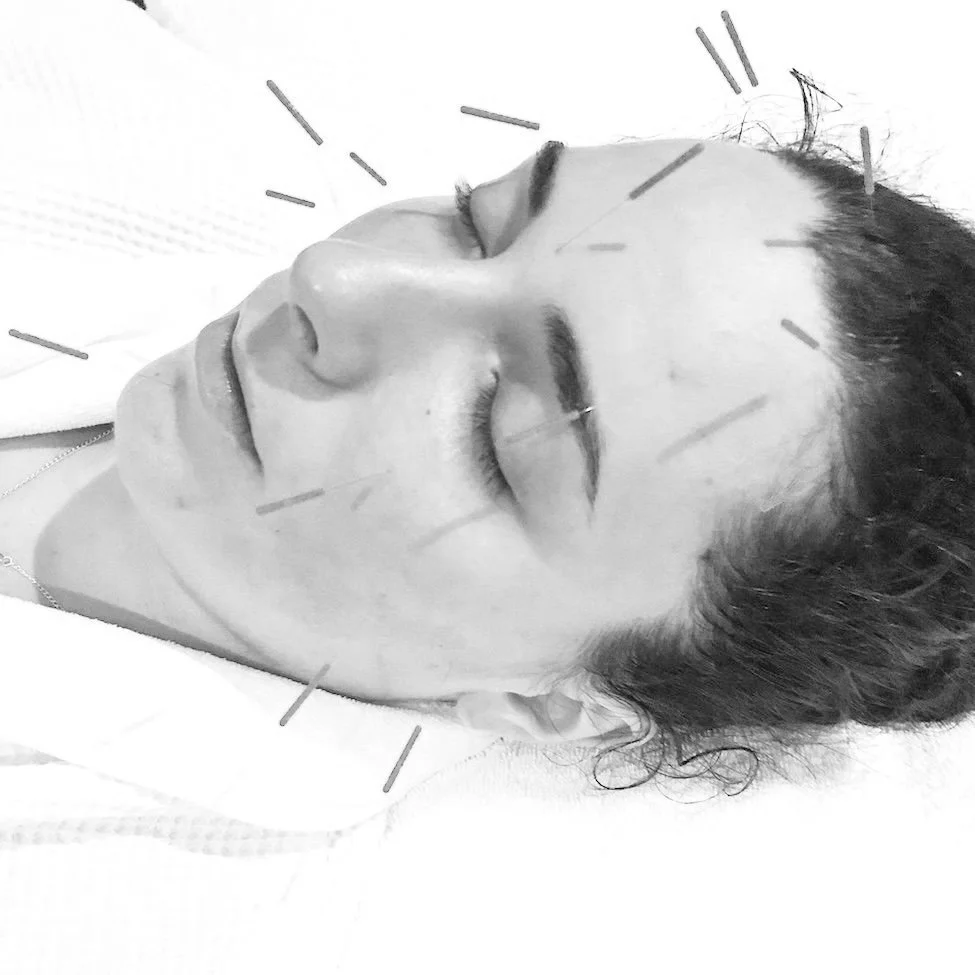 Holistic TCM Dermatology in SLC: Natural Skin Health