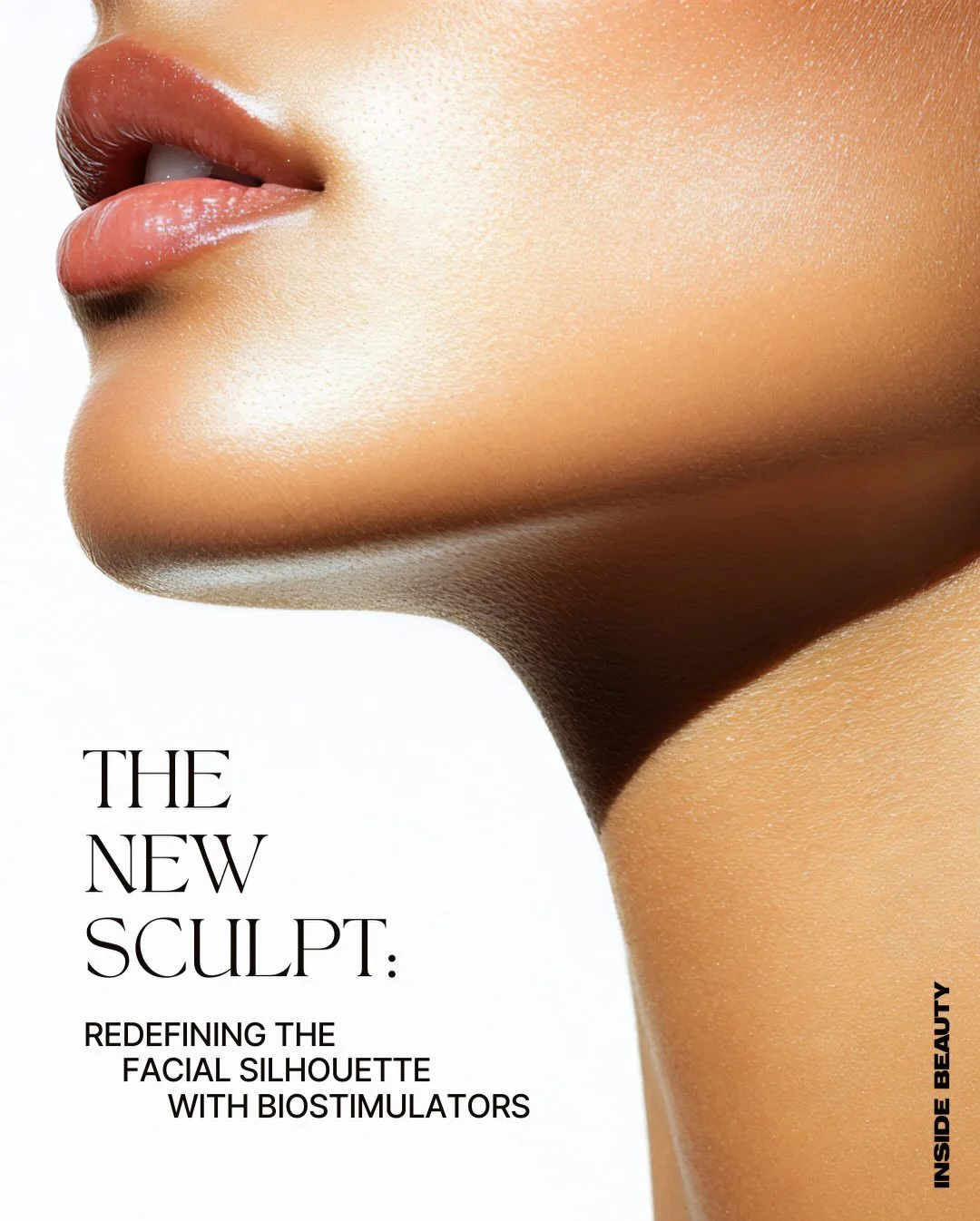 The era of &ldquo;filler&rdquo; is evolving into the era of bio-regeneration. 

While traditional hyaluronic acid fillers are excellent for adding volume, Radiesse&reg; belongs to a different class: Biostimulators. 

Rather than just &ldquo;filling&r