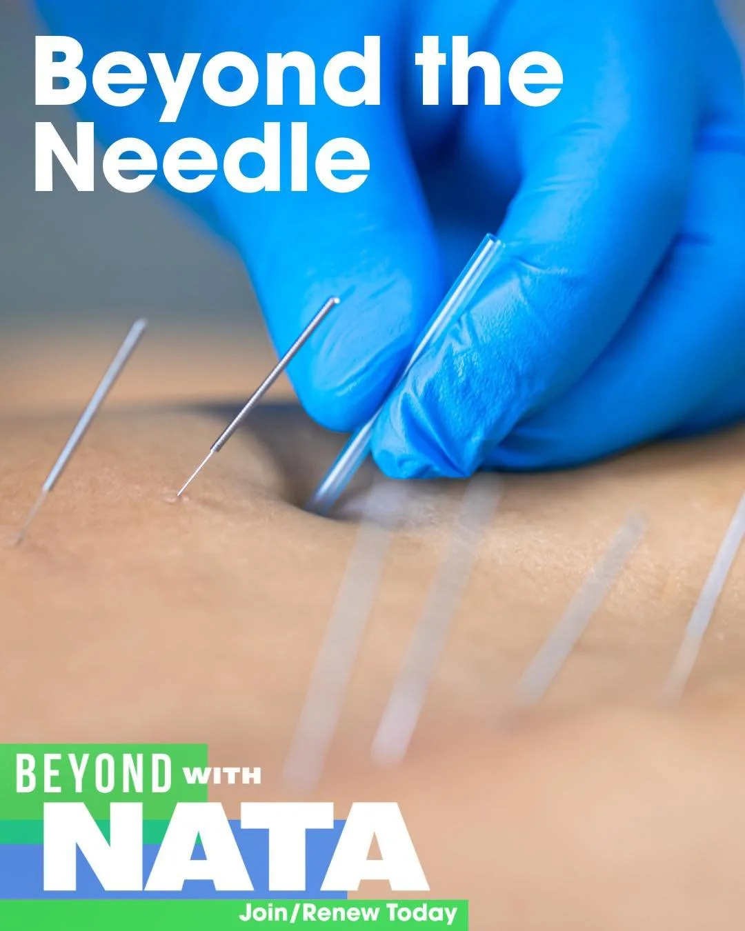 Beyond the Needle
As an NATA Student Member, don’t forget you get full access to 150+ NATA EducATe courses that connect your studies to real-world practice and supplement your learning. Popular picks include De-ICED and Dry Needling: What&rsqu