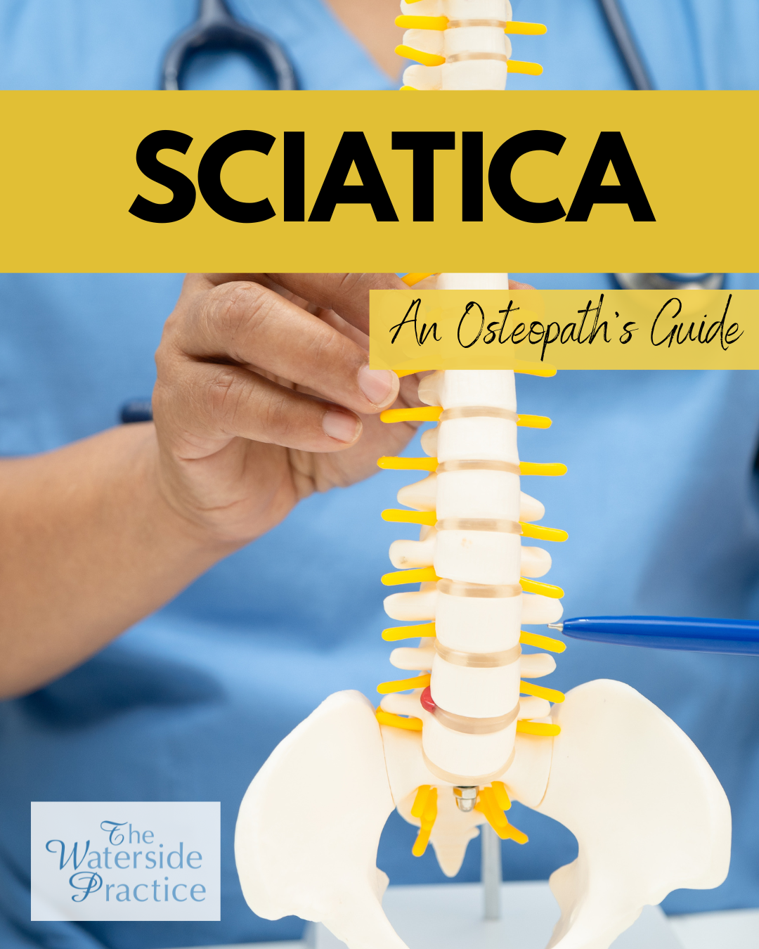An Osteopath’s Guide to Sciatica