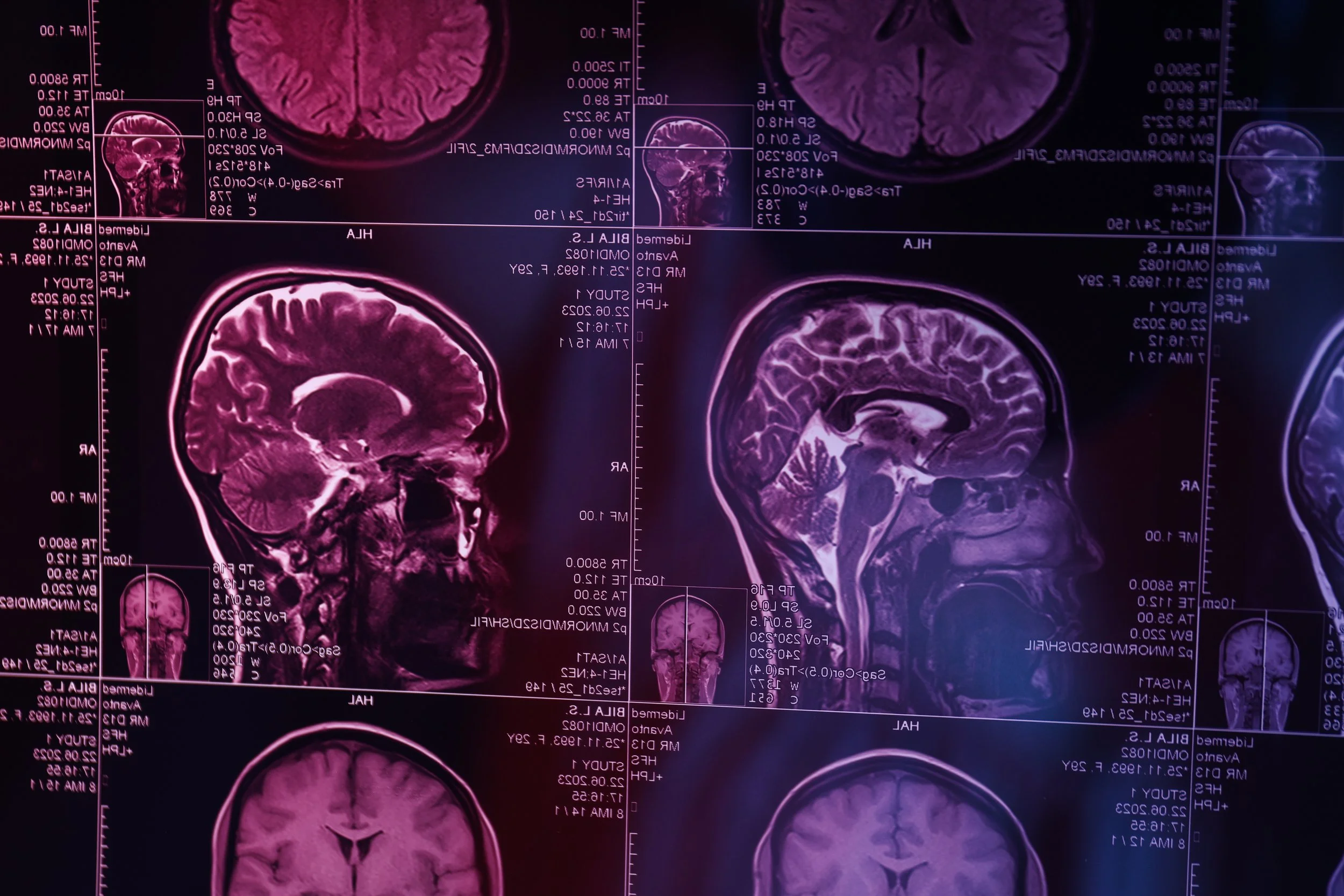 Neurobiología y psicopatía