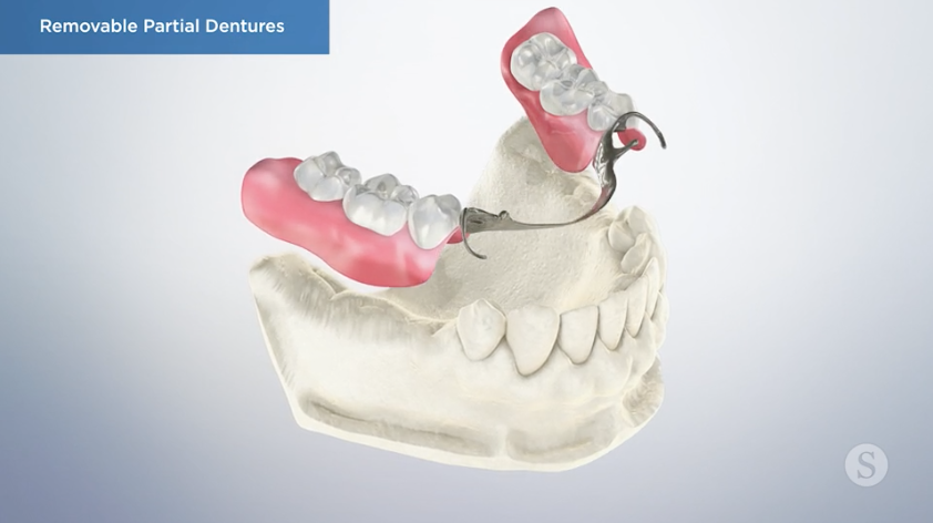 Your Denturist's Work