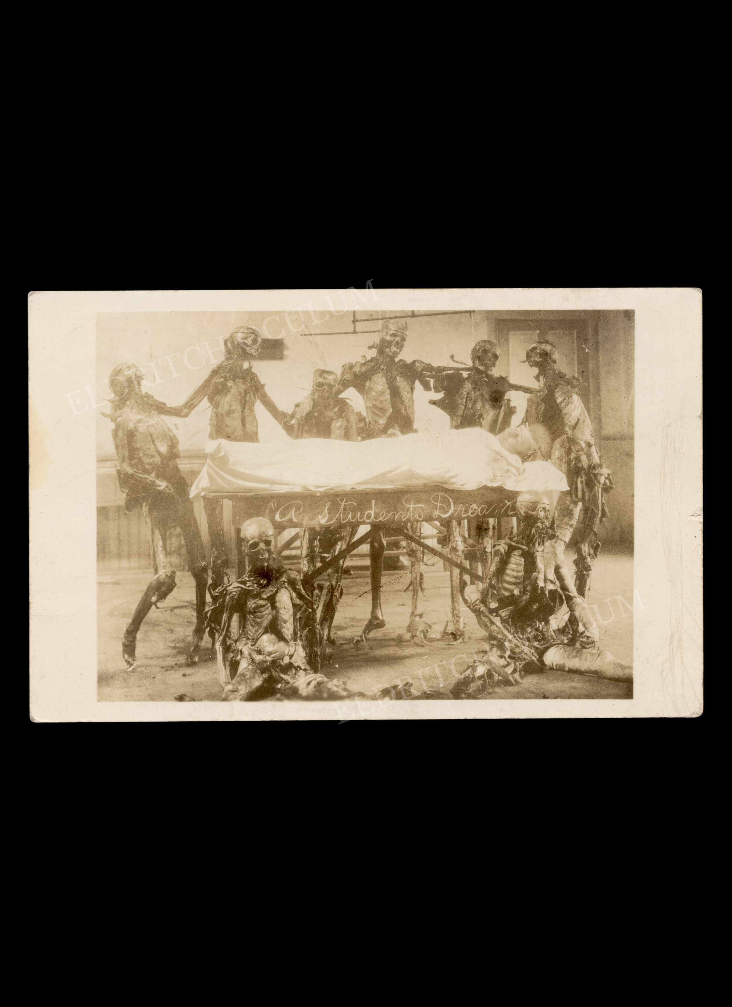 “A Student’s Dream”, Medical Student Nightmare of Being Operated on by Real Cadavers, real-photo postcard, c. 1908