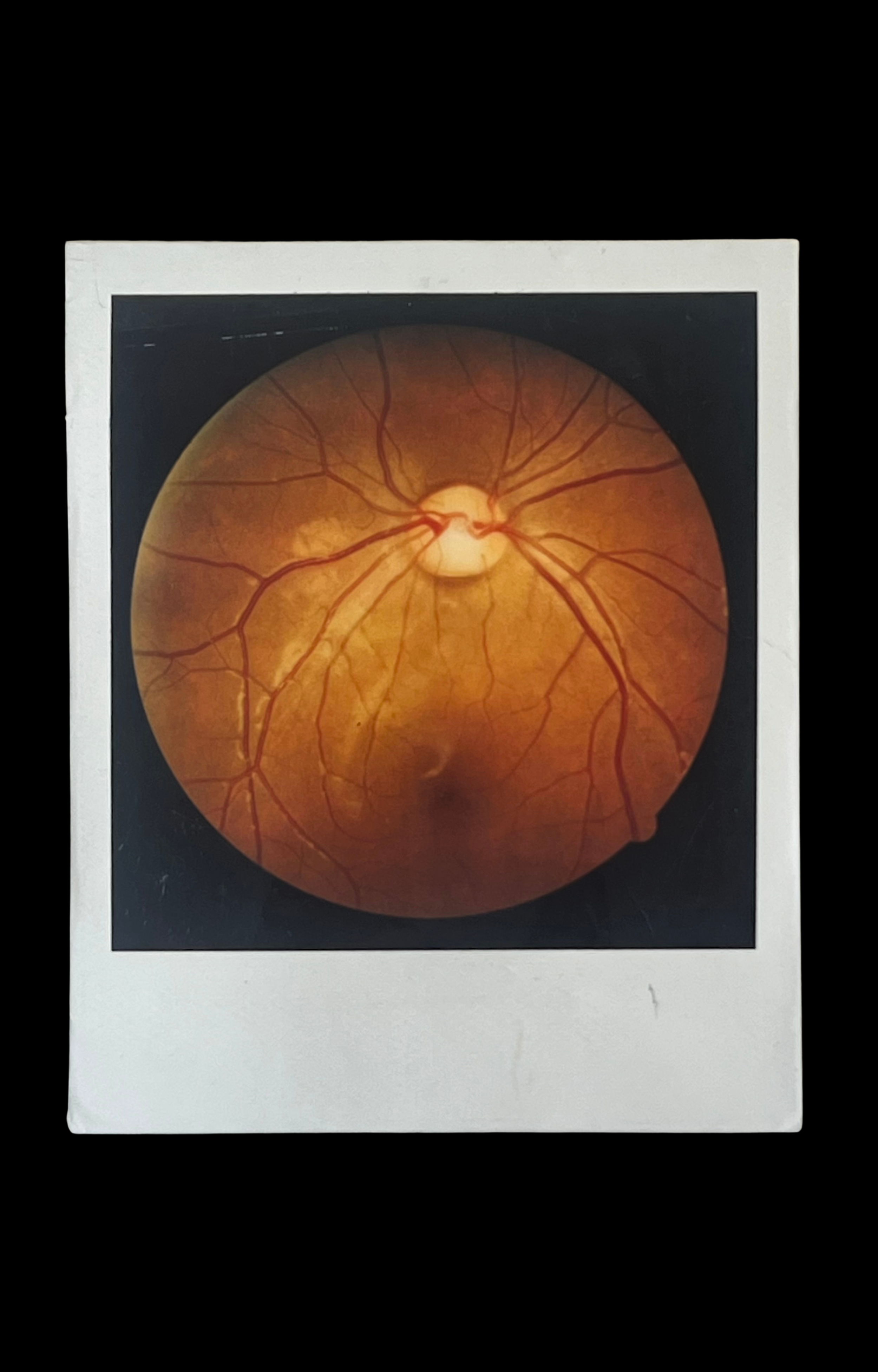 Polaroid of Back of Human Eye, c. 1980
