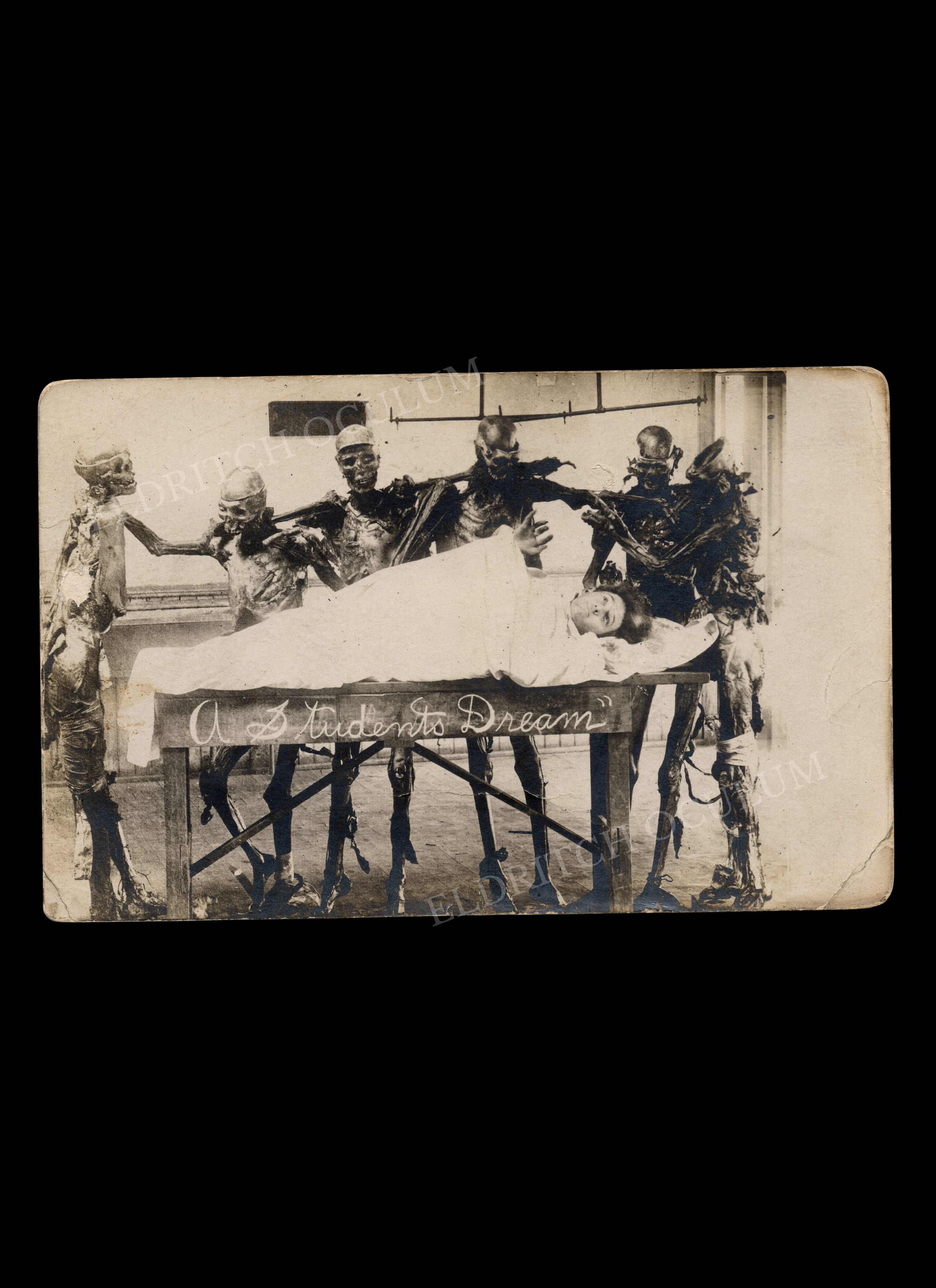 “A Student’s Dream”, Medical Student Nightmare of Being Operated on by Real Cadavers, real-photo postcard, c. 1910