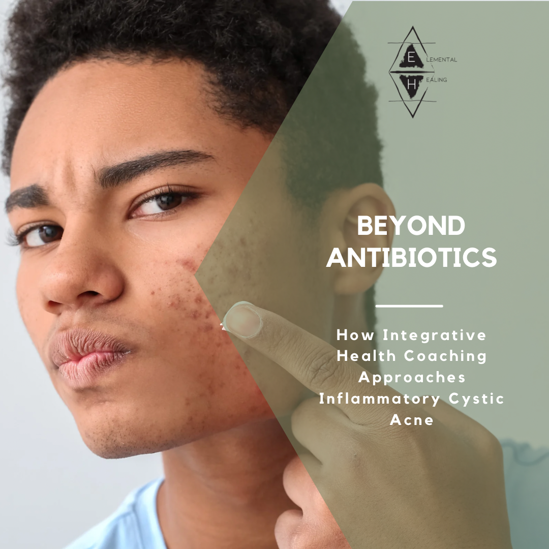 Beyond Antibiotics: Integrative Adjuncts for Cystic, Pustular, and Hormonal Acne