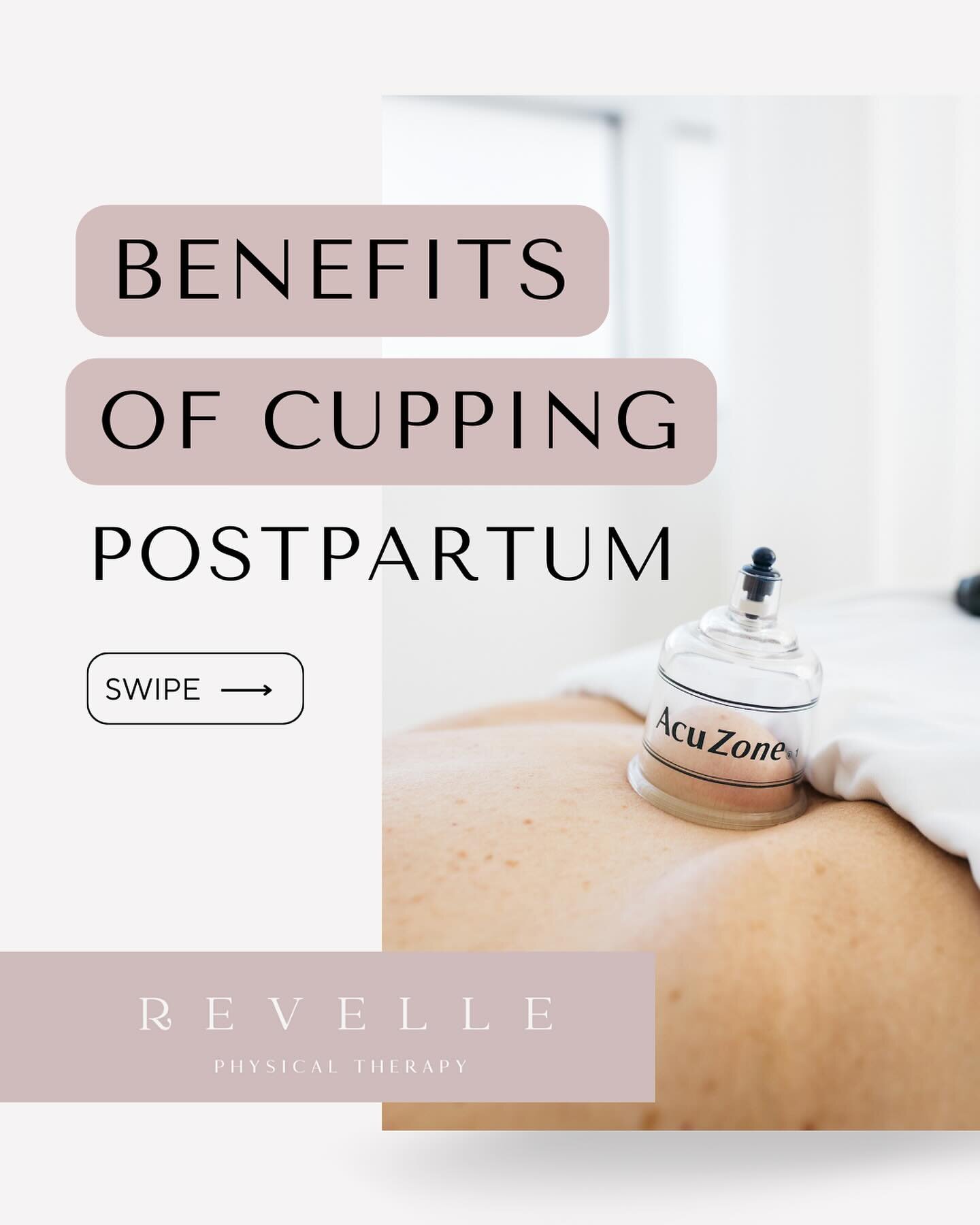 Why we love cupping therapy postpartum😍

Cupping has been recognized for its ability to facilitate healing, especially after childbirth.

It&rsquo;s like giving those areas that worked so hard during pregnancy and birth the extra love they deserve&m