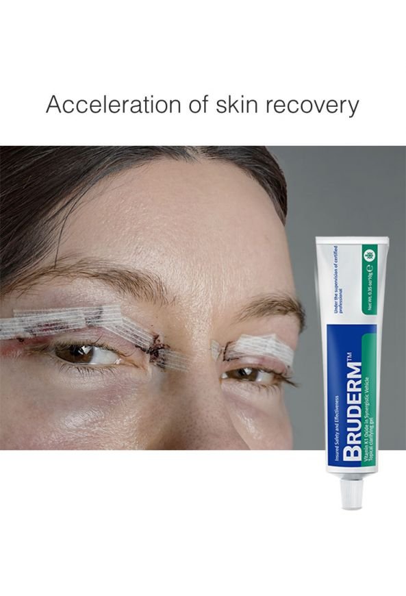 Non-steroidal bruise treatment with Arnica, Vitamin E & Aloe – Reduces swelling & discoloration