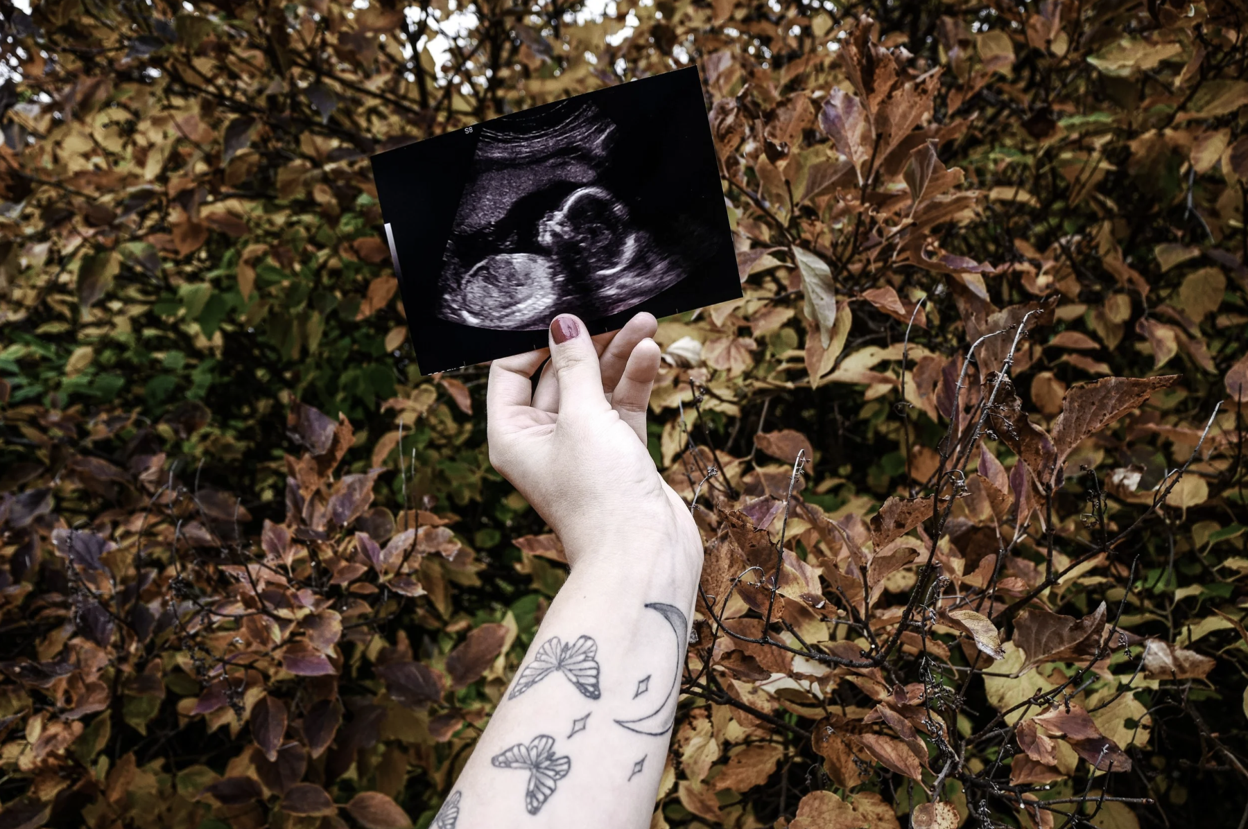 Tattooed hand holding an ultrasound photo against autumn leaves — a personal essay about postpartum rage and generational trauma
