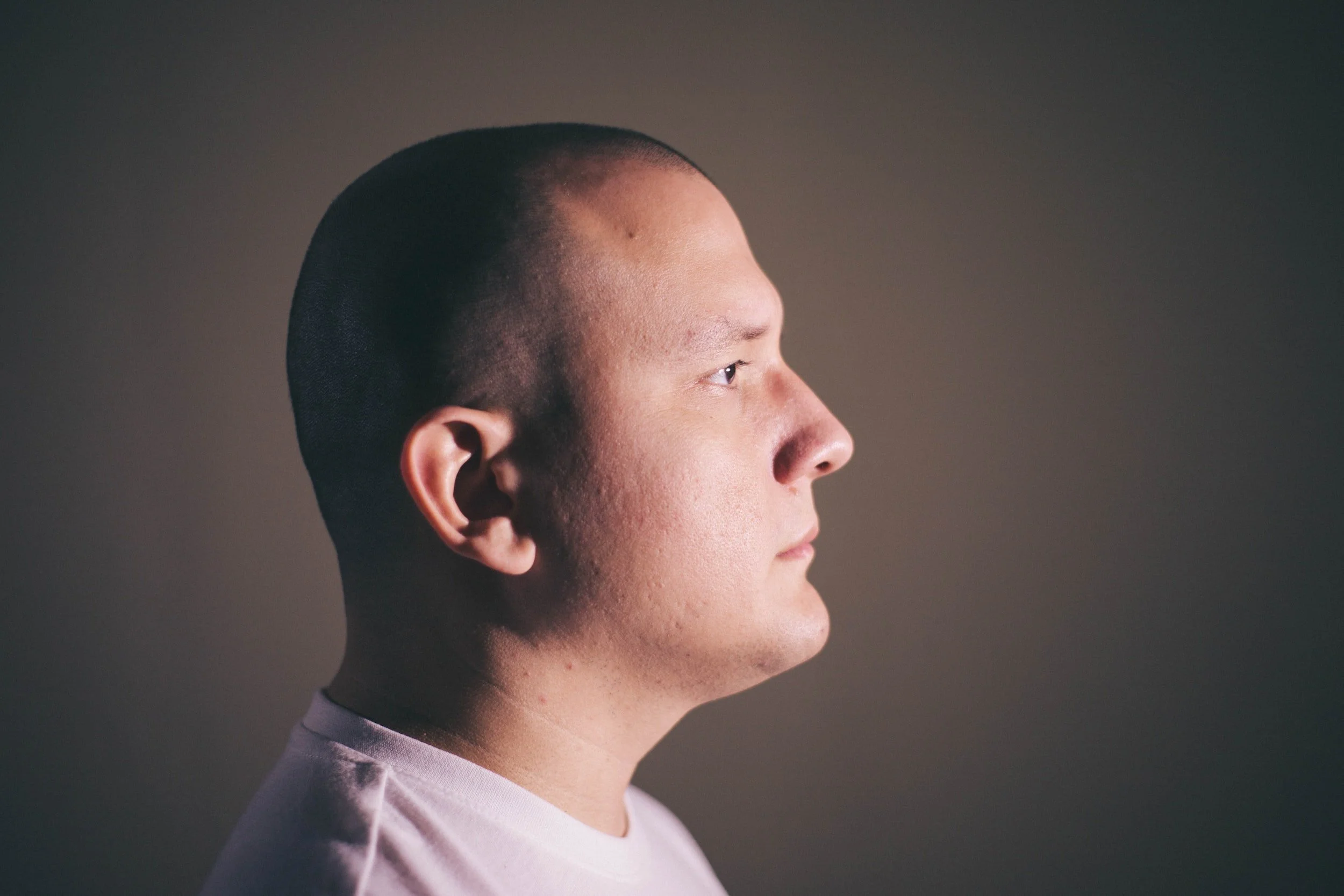 Dry Scalp vs Dandruff: What's the Difference?