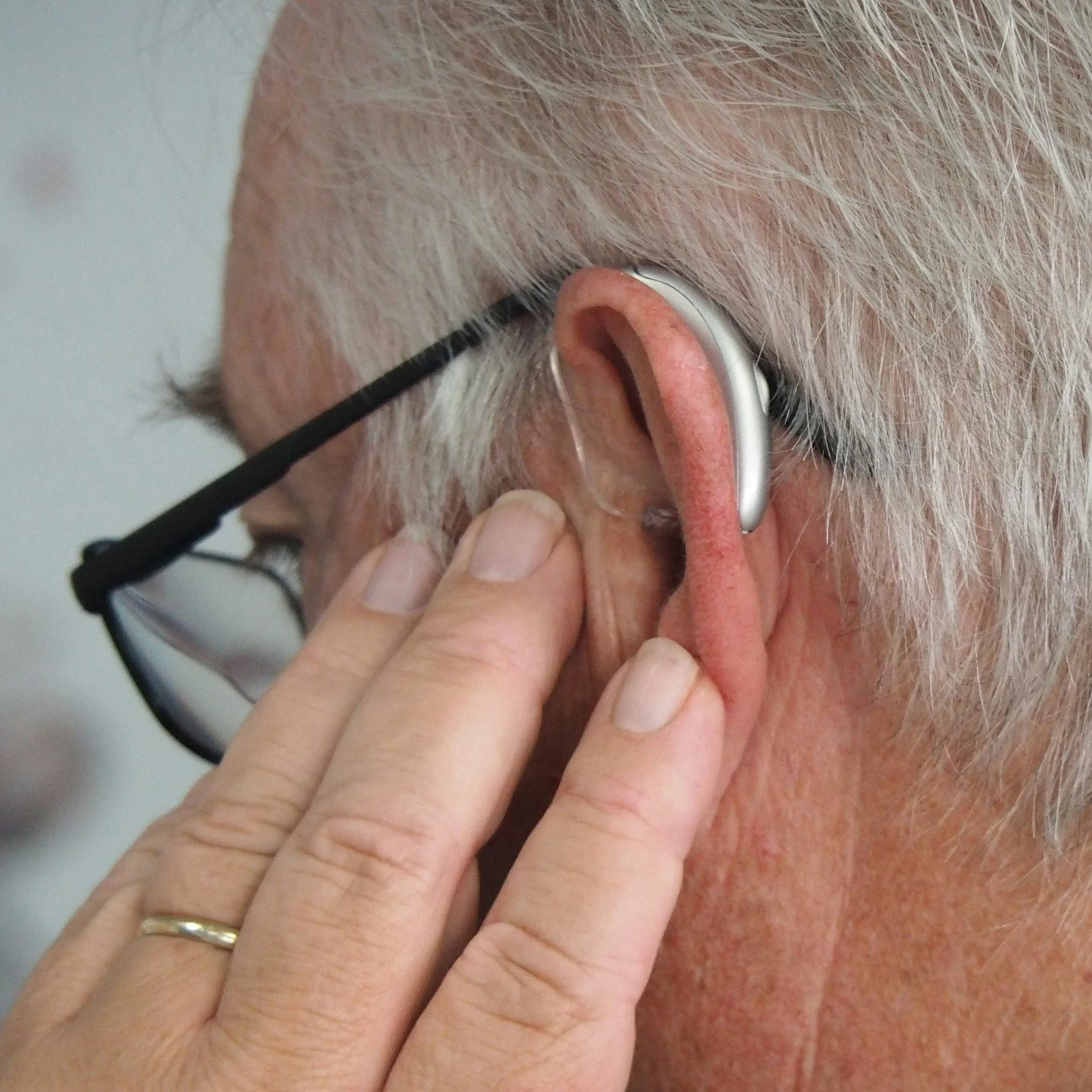 Hearing Loss and Dementia